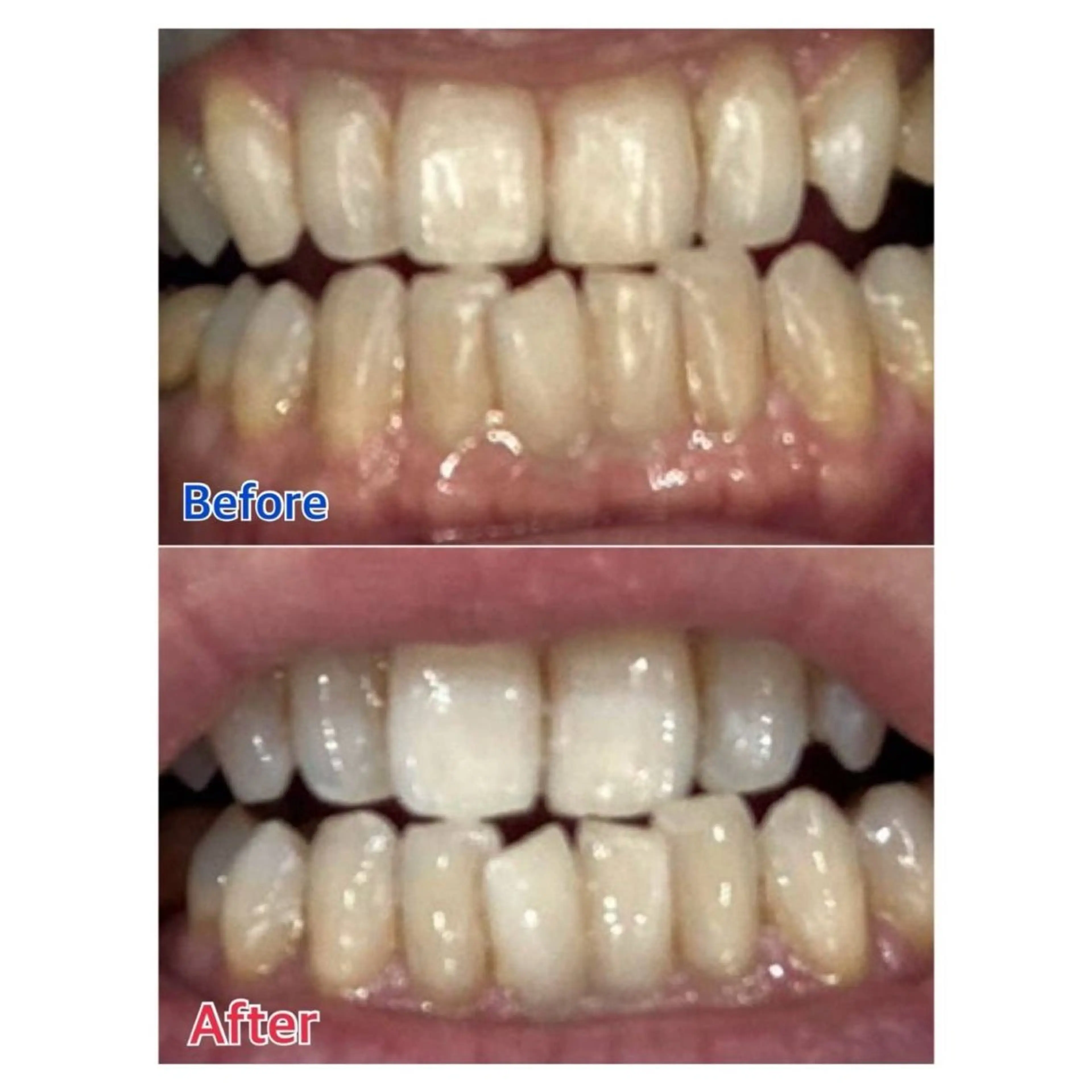 Melty 輝のその他イメージ