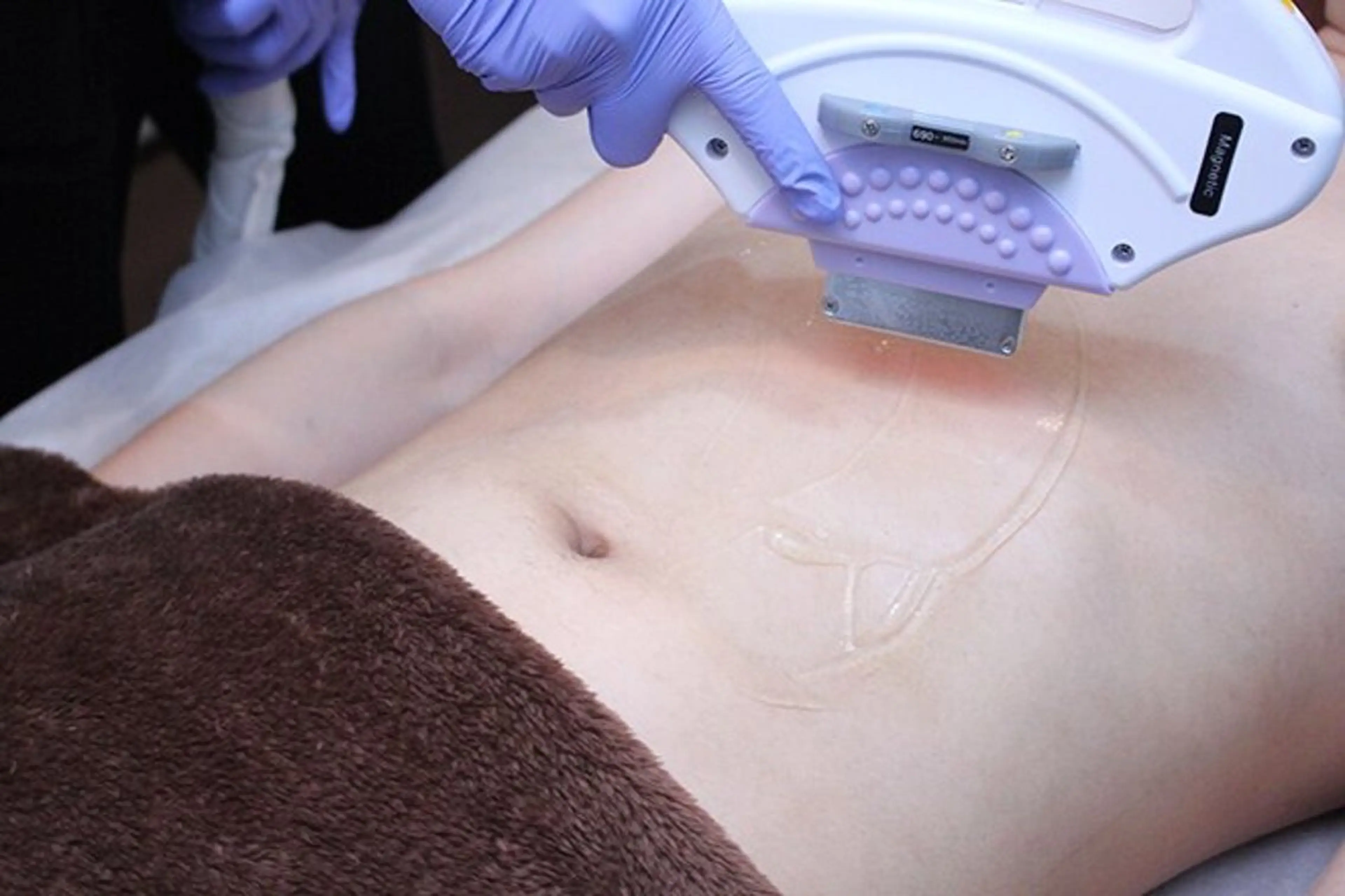 脱毛 安井 美和のエステ・リラクイメージ