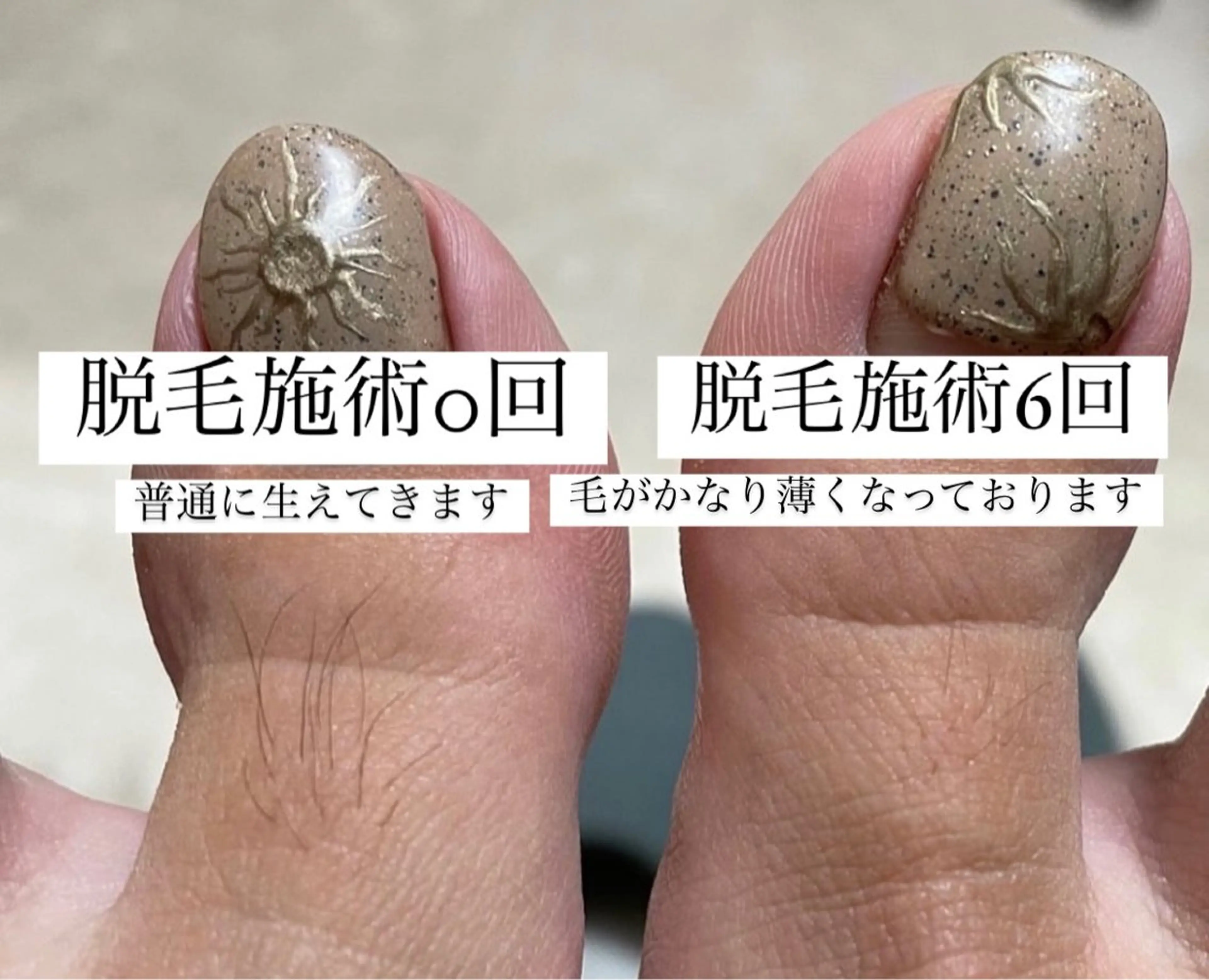 メンズ 脱毛 Anela .のマツエク・マツパデザイン