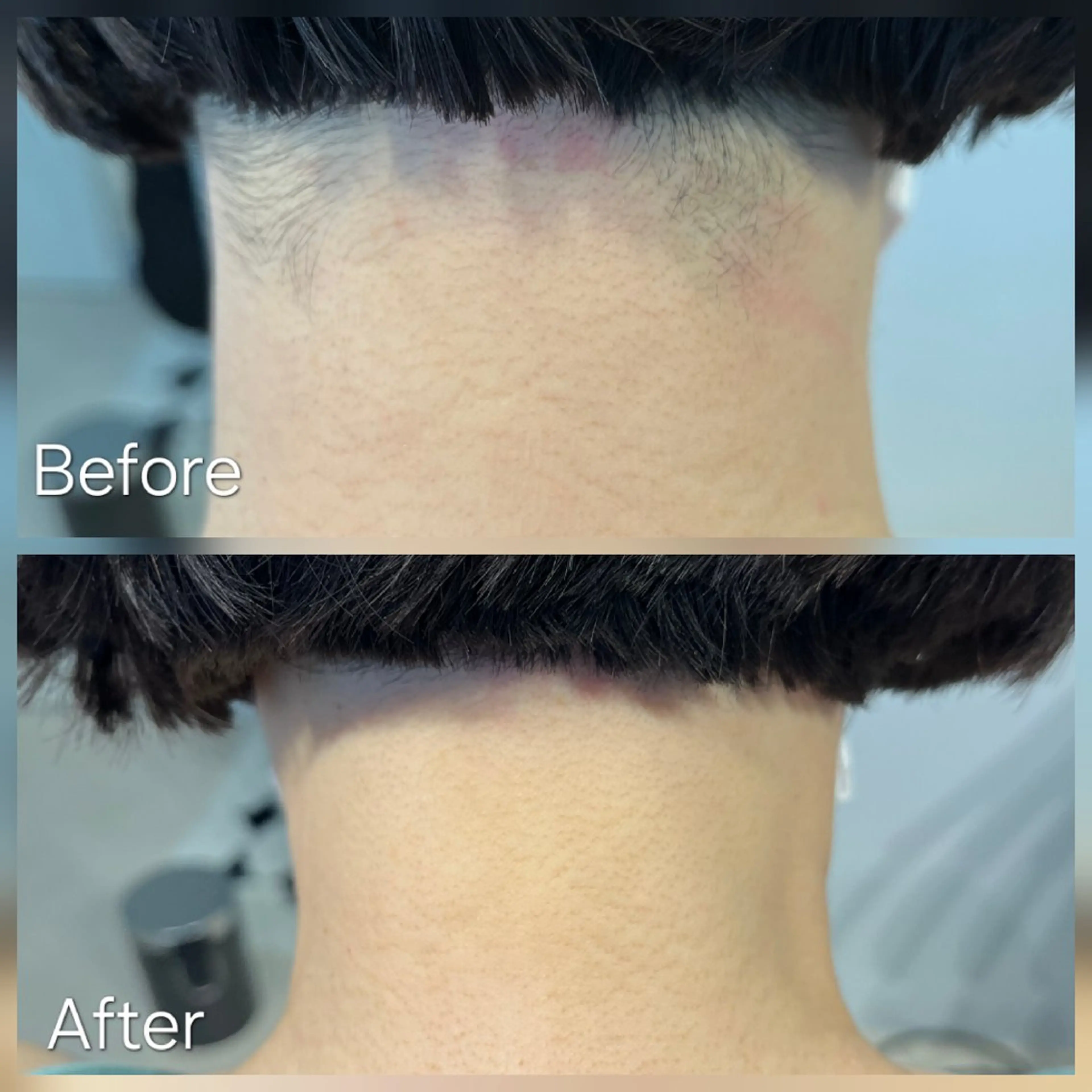 脱毛 シュガーリング/脱毛 EARLS 三軒茶屋のエステ・リラクイメージ