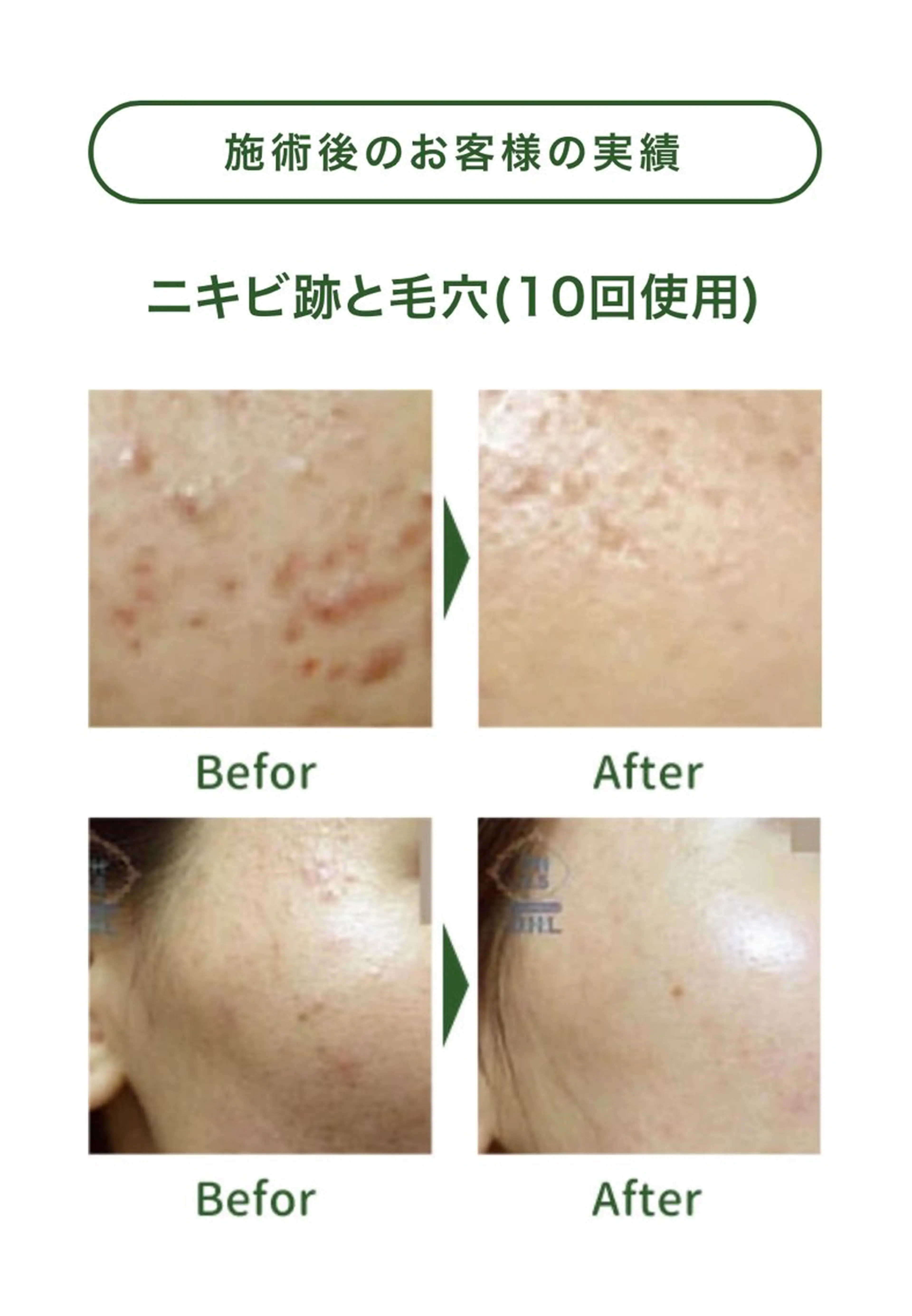 サロンur（ユア） Rieのエステ・リラクイメージ