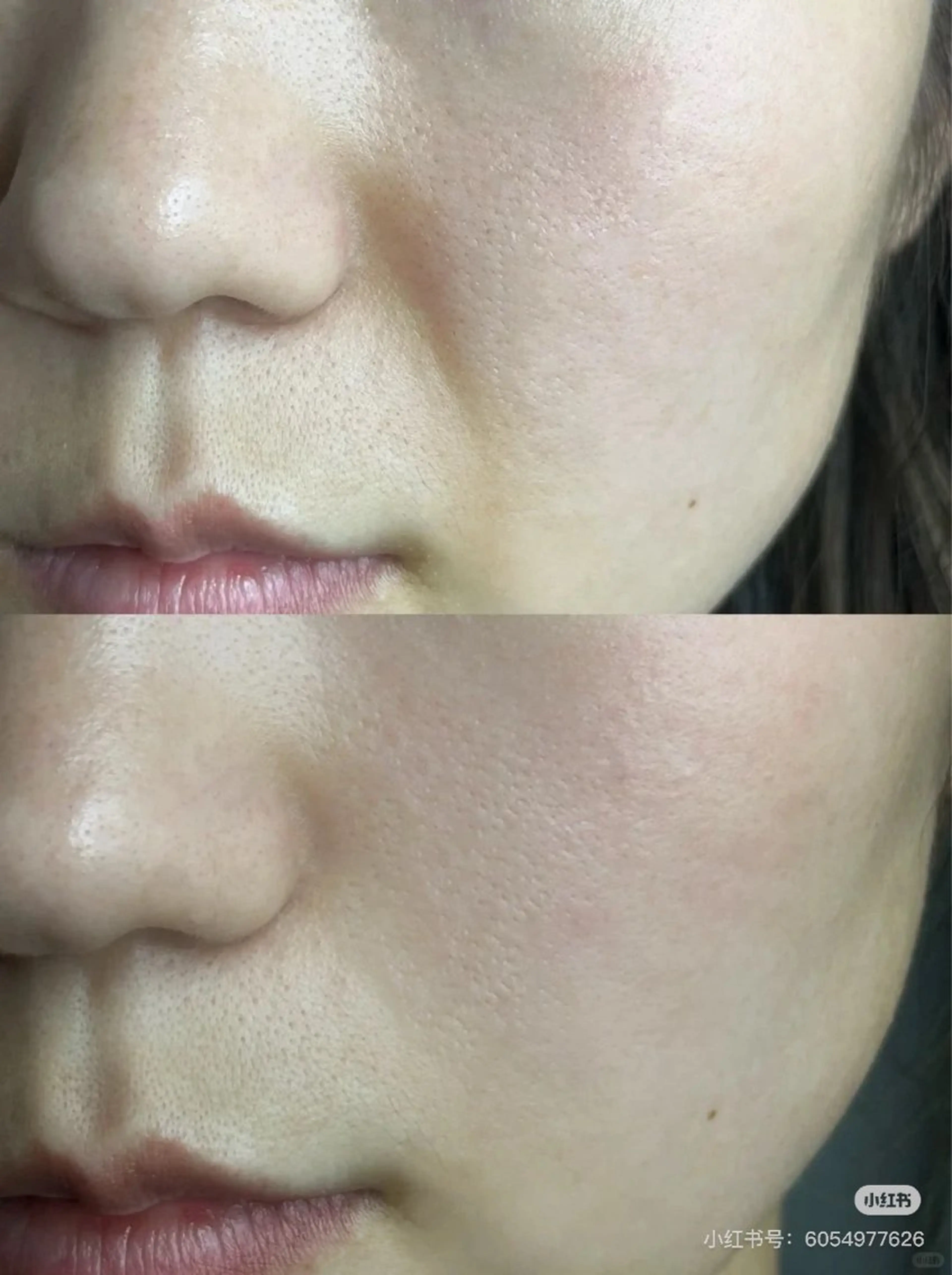 マツエク・マツパ エステ aliaハイフ&水光ジェットサロン所属・aliaハーブ水光店 エステティシャン募集のエステ・リラクイメージ