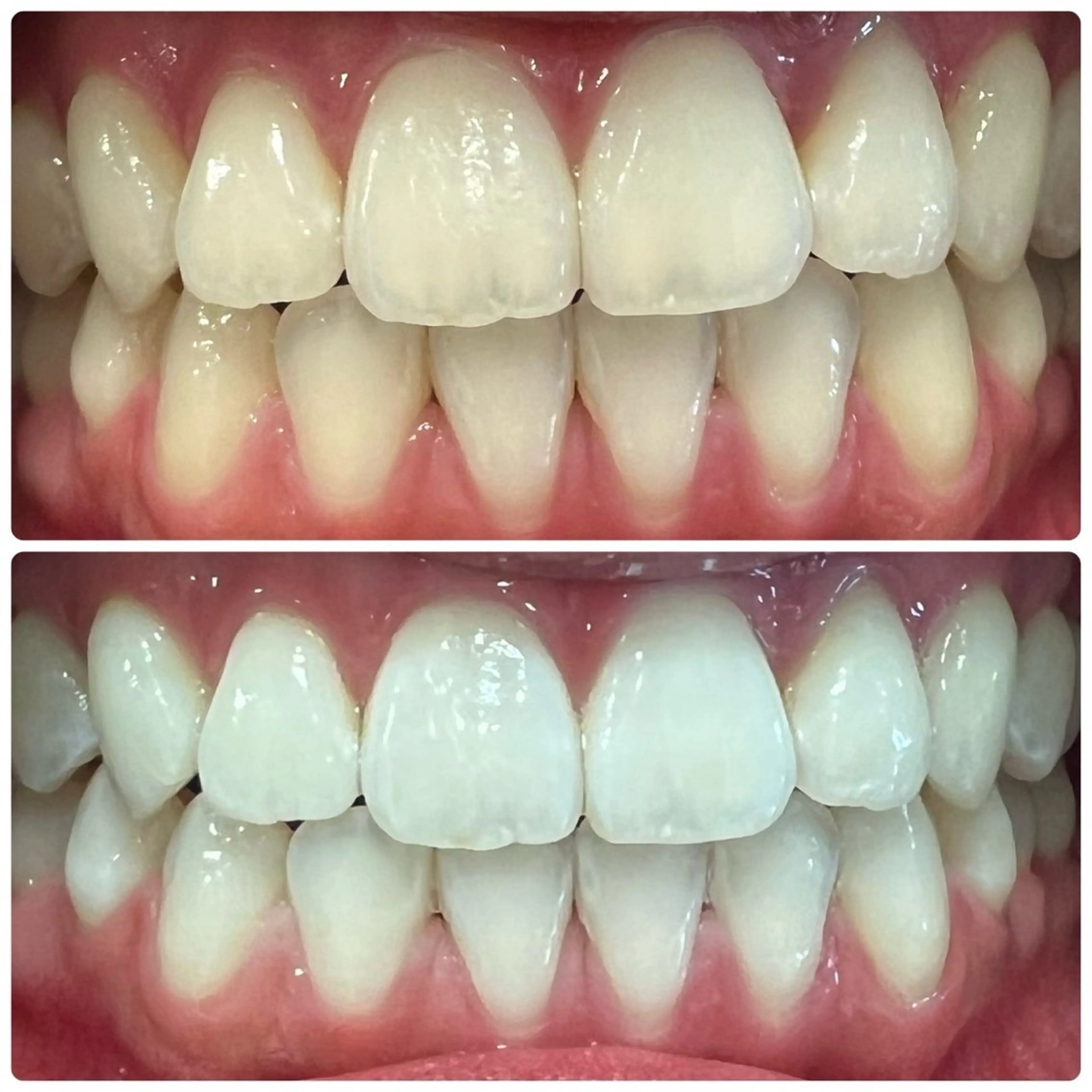 その他 ホワイトニングルーム 横浜店のその他イメージ