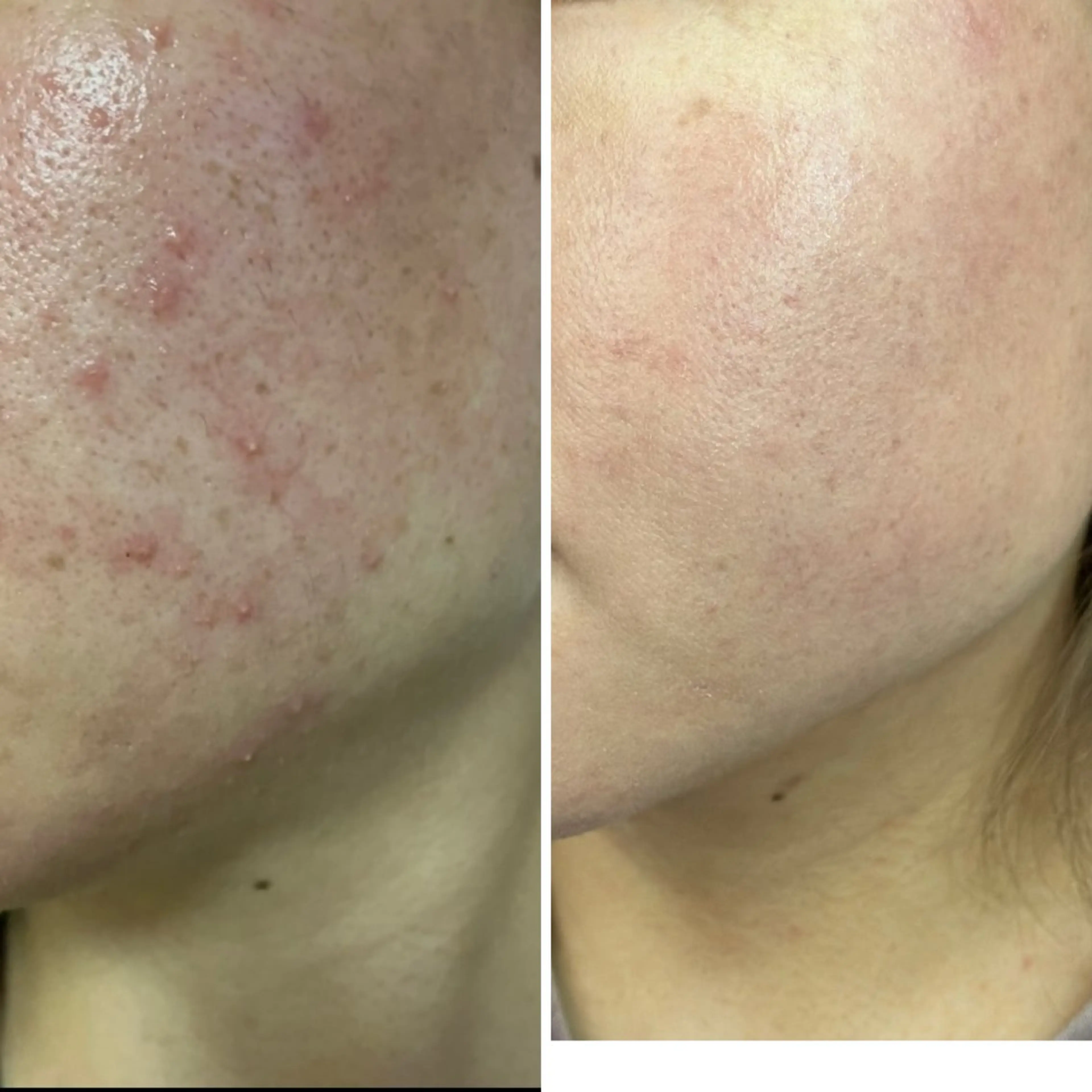 mison所属・mison 安形友花のネイルデザイン