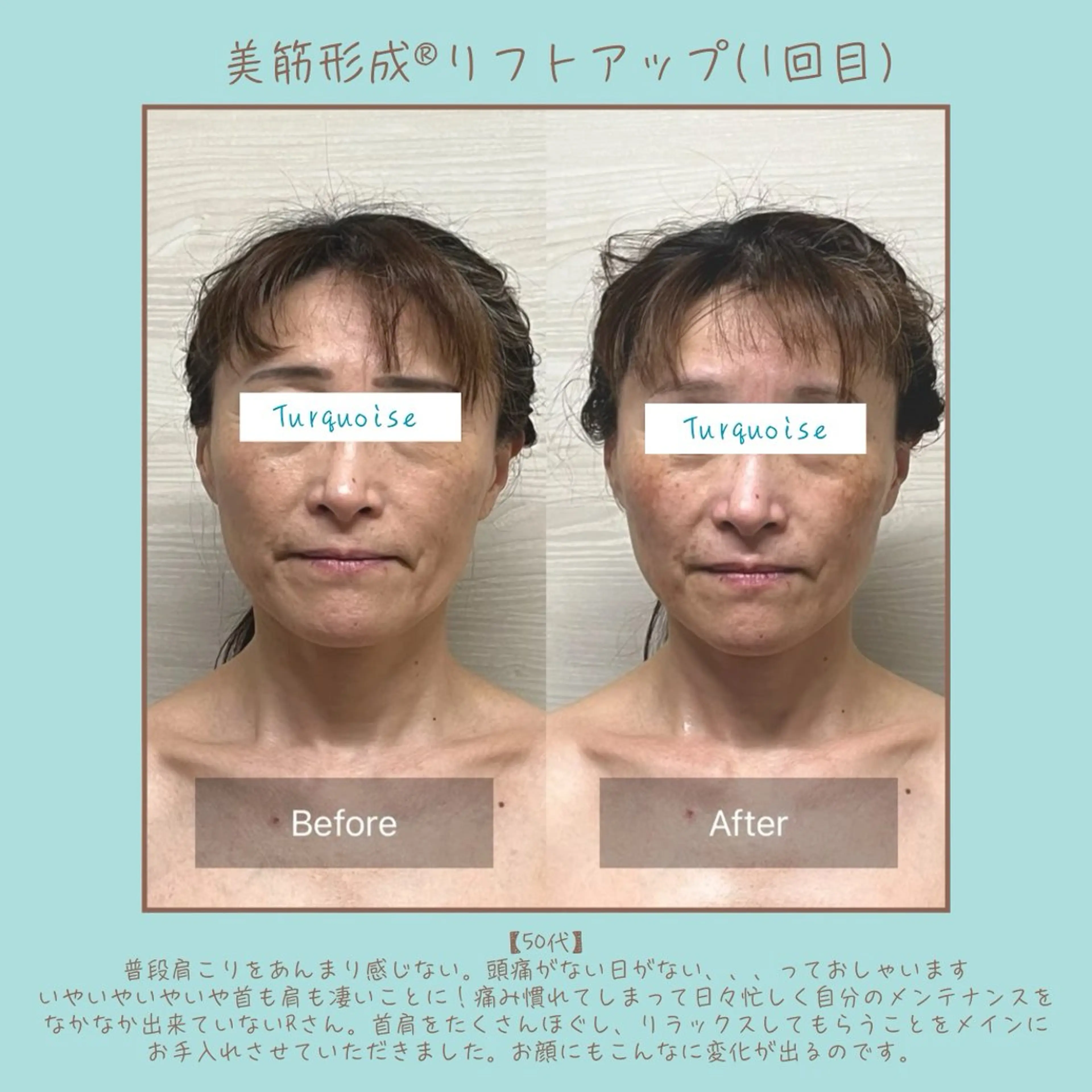 フェイシャルエステ Turquoiseのエステ・リラクイメージ