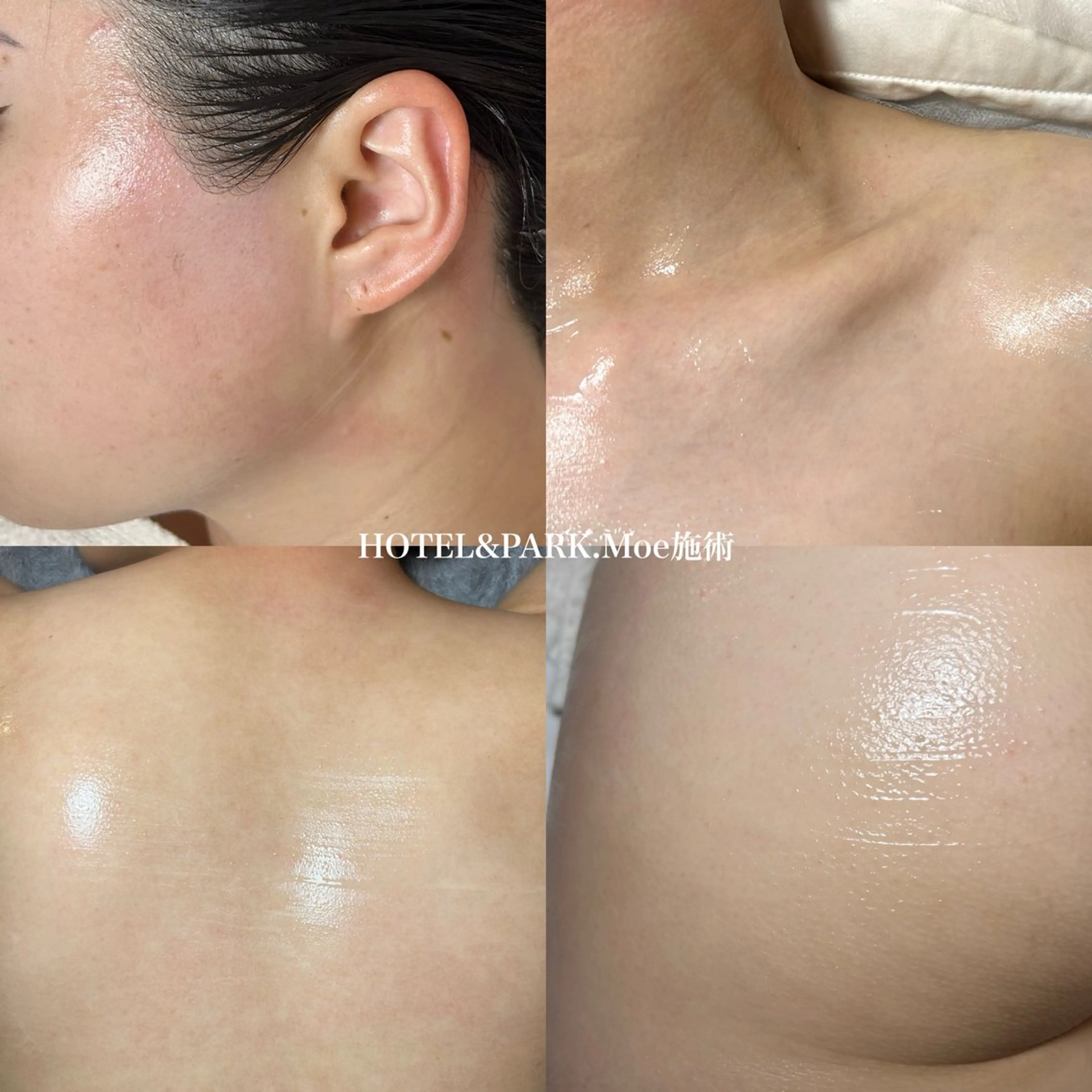 HOTEL&PARK .Moeワックス脱毛のエステ・リラクイメージ