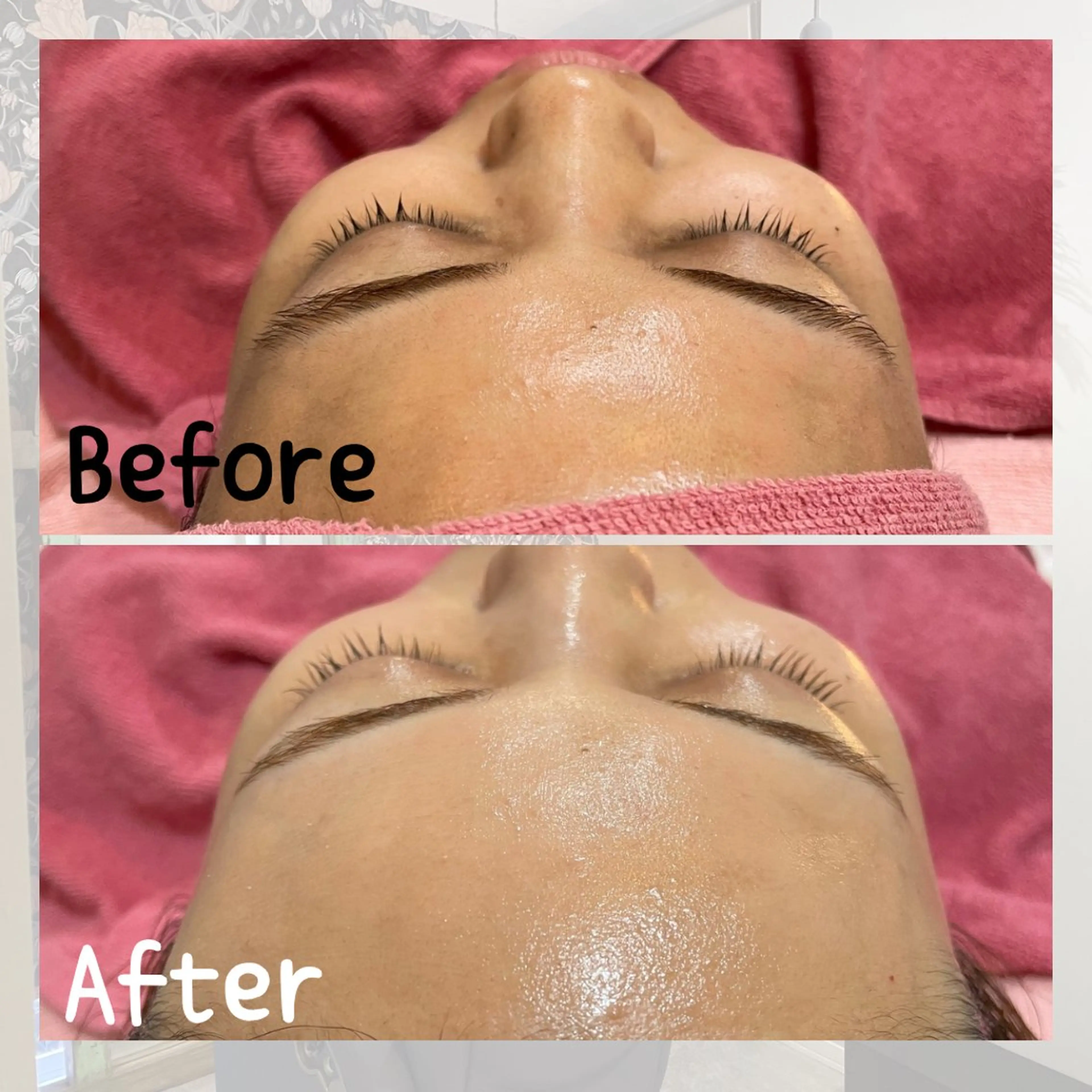 [ミニモ人気メニュー✨]シェービング🪞＋ドライヘッドスパ💆‍♀️の写真