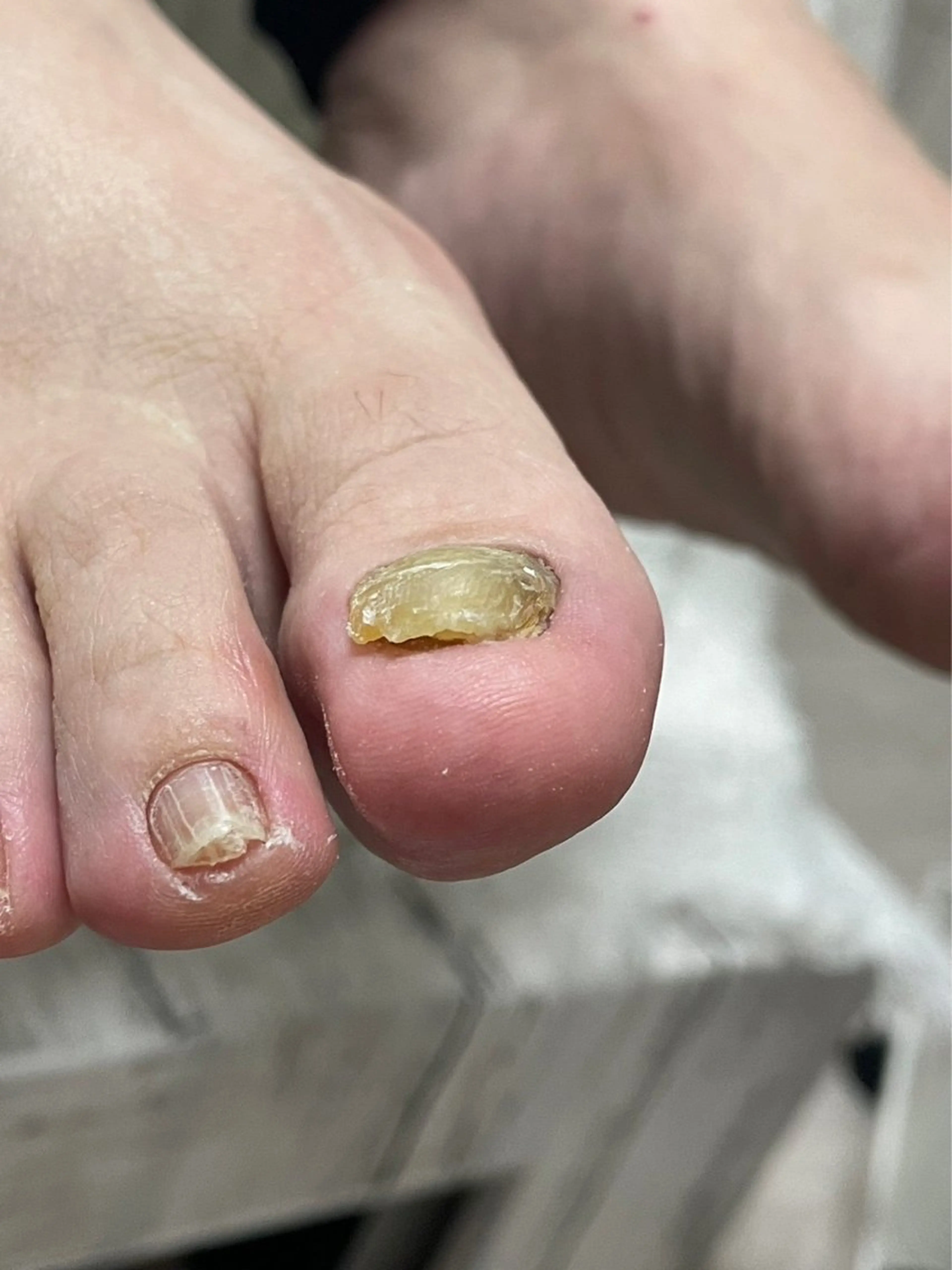 ネイル フットネイル Belulu ベルルのネイルデザイン