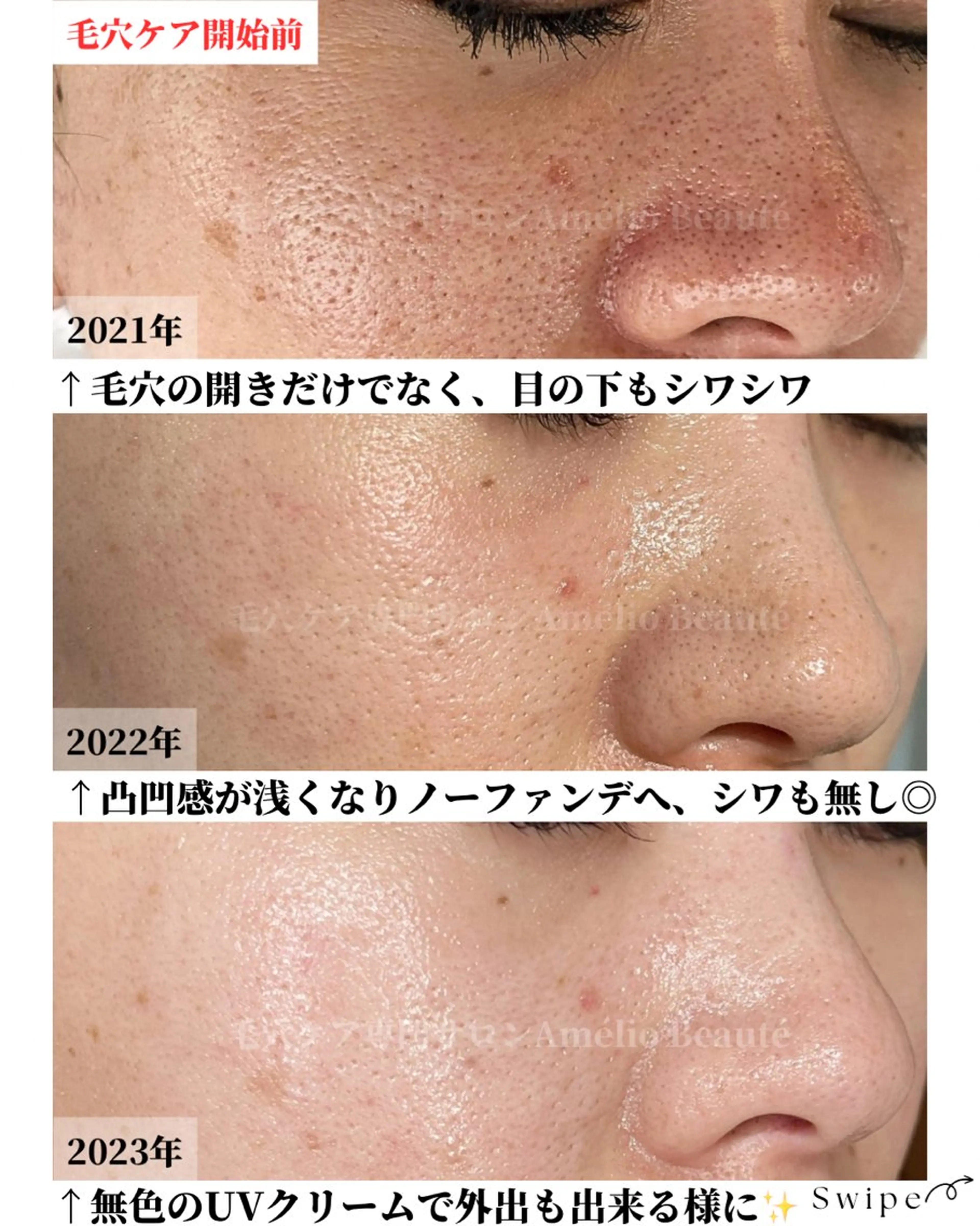 メンズ 毛穴ケア専門サロン アメリオボーテのその他イメージ