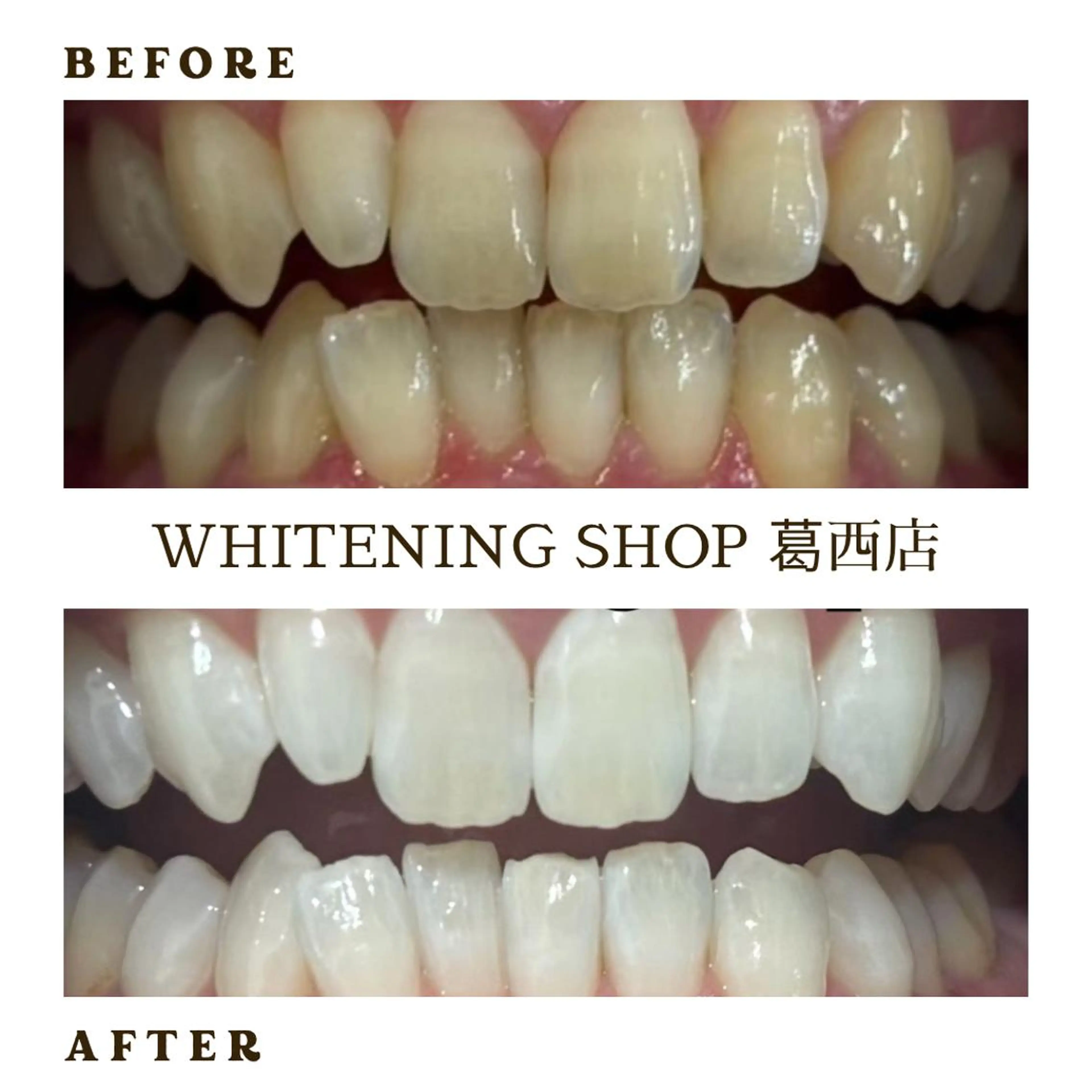 メンズ その他 ホワイトニング ショップ葛西店のその他イメージ