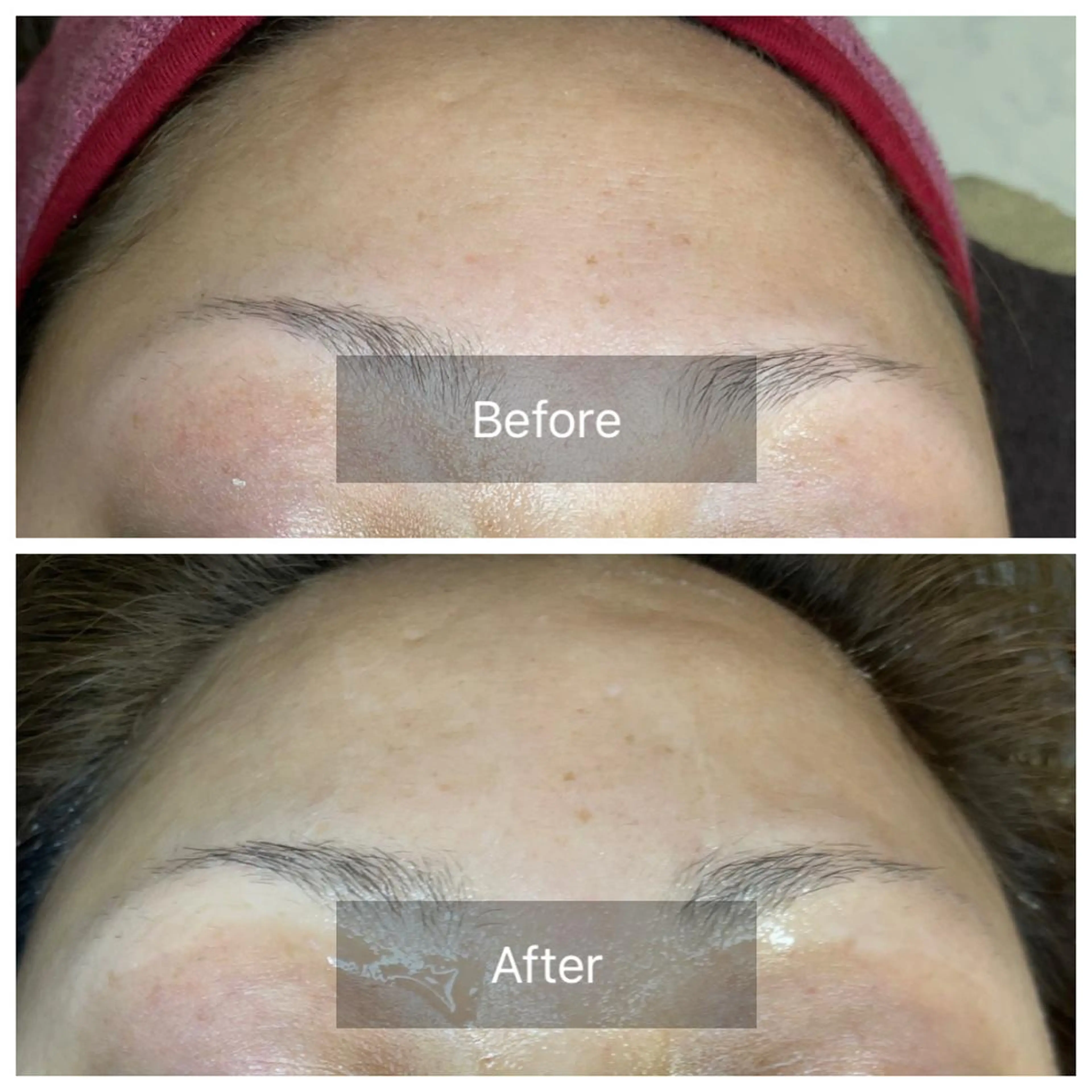 肌質改善サロン facialmoonのエステ・リラクイメージ