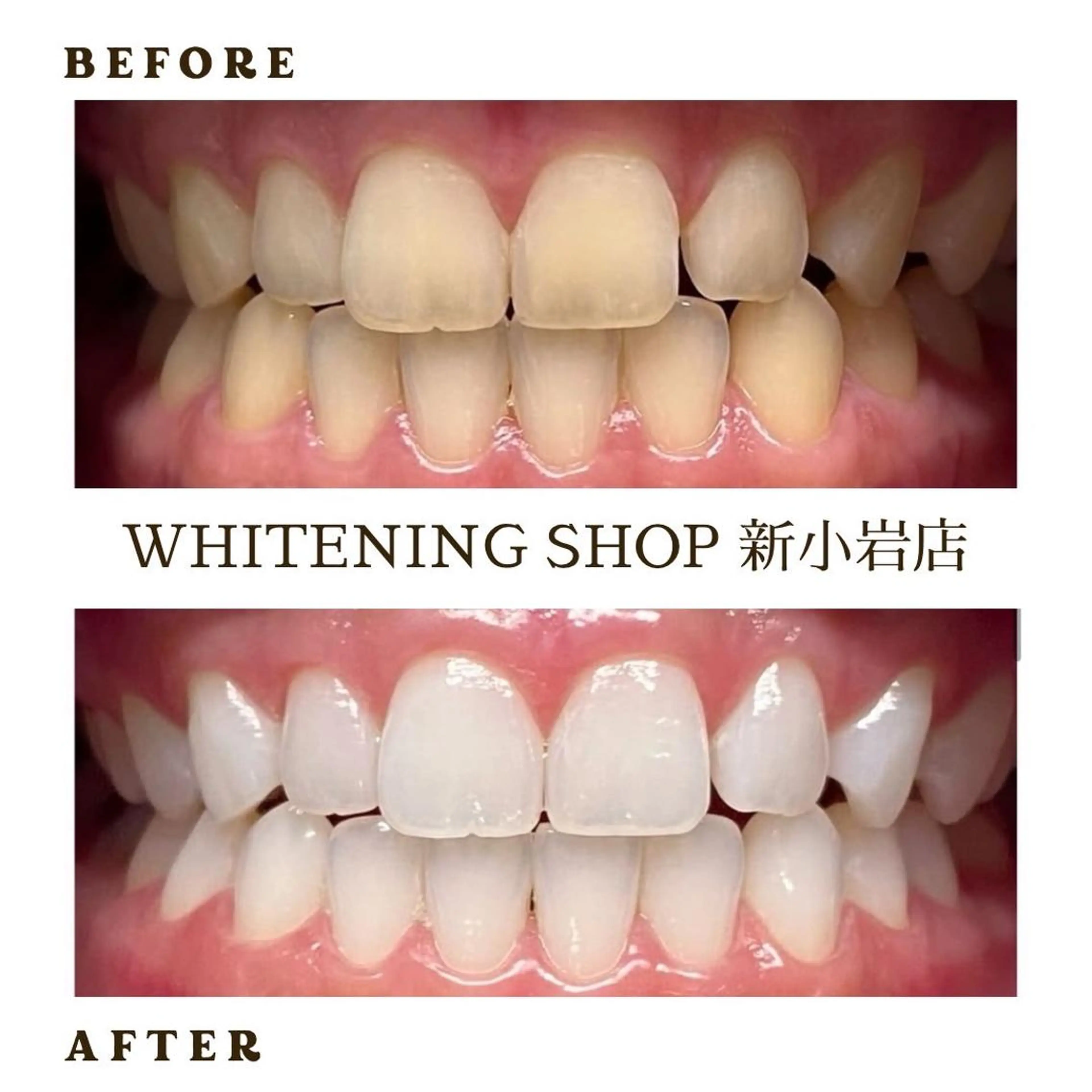 メンズ ホワイトニング ショップ新小岩店のその他イメージ