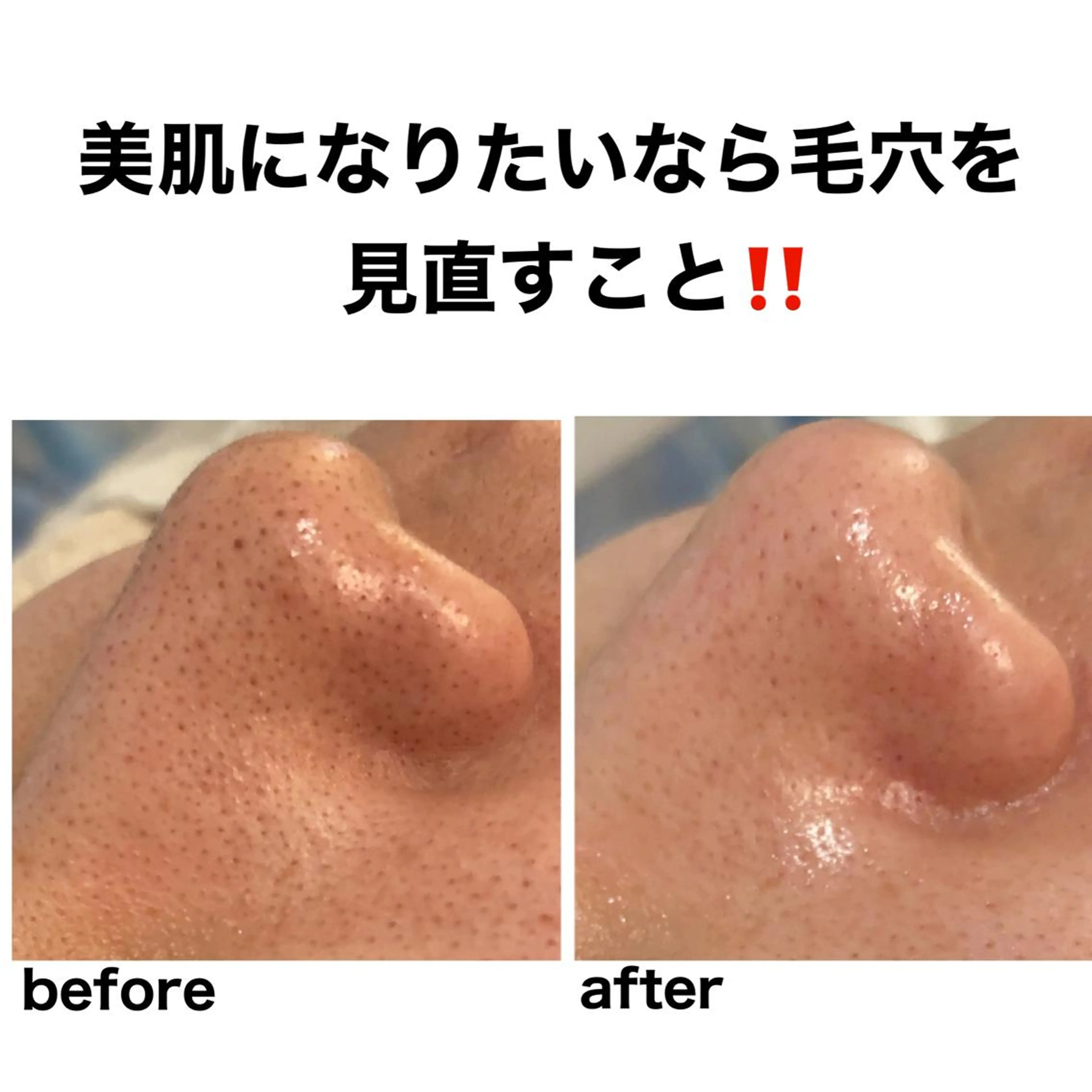 エステ 毛穴・シミ専門サロン ルパークのエステ・リラクイメージ