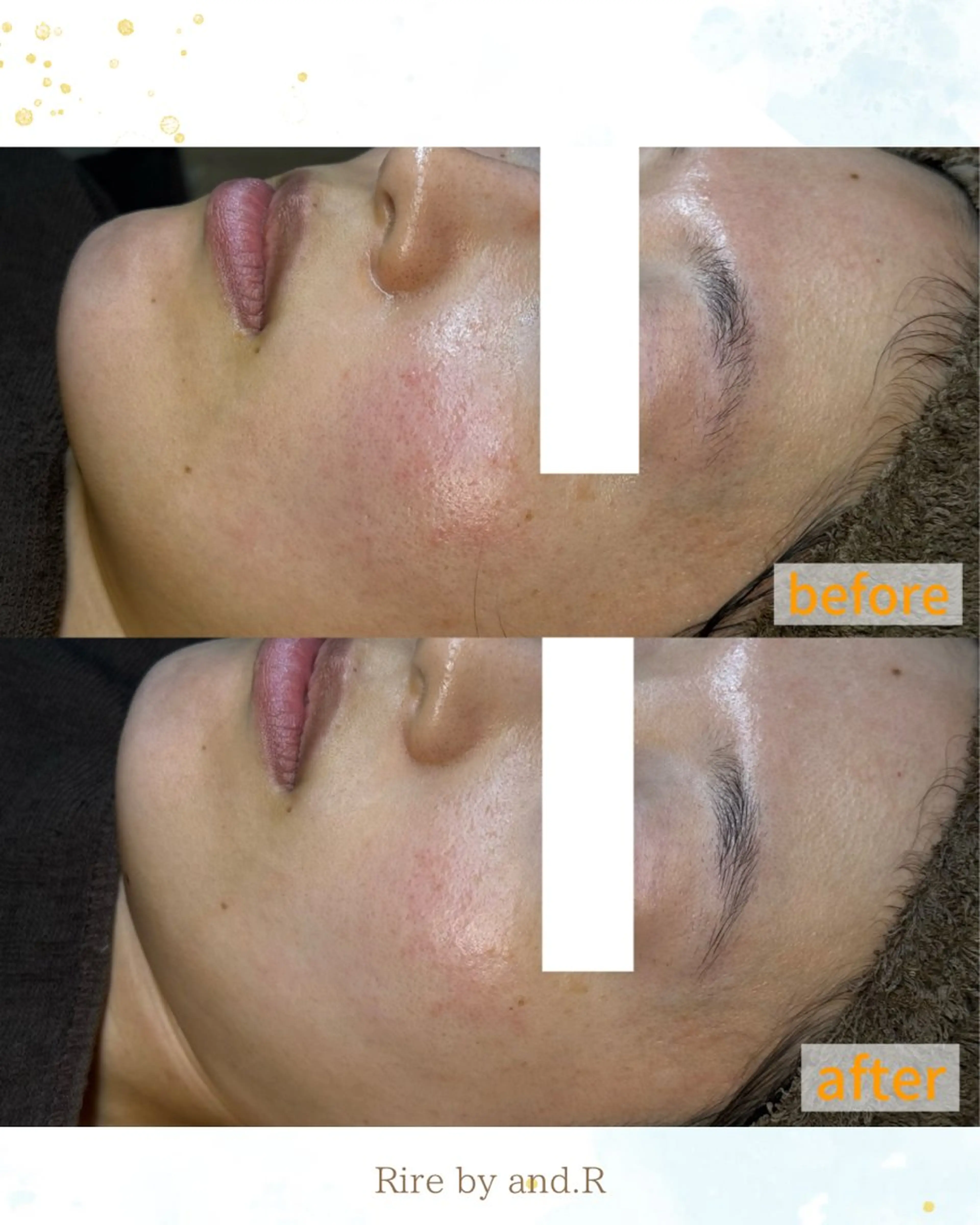 エステ 長野 美里のエステ・リラクイメージ