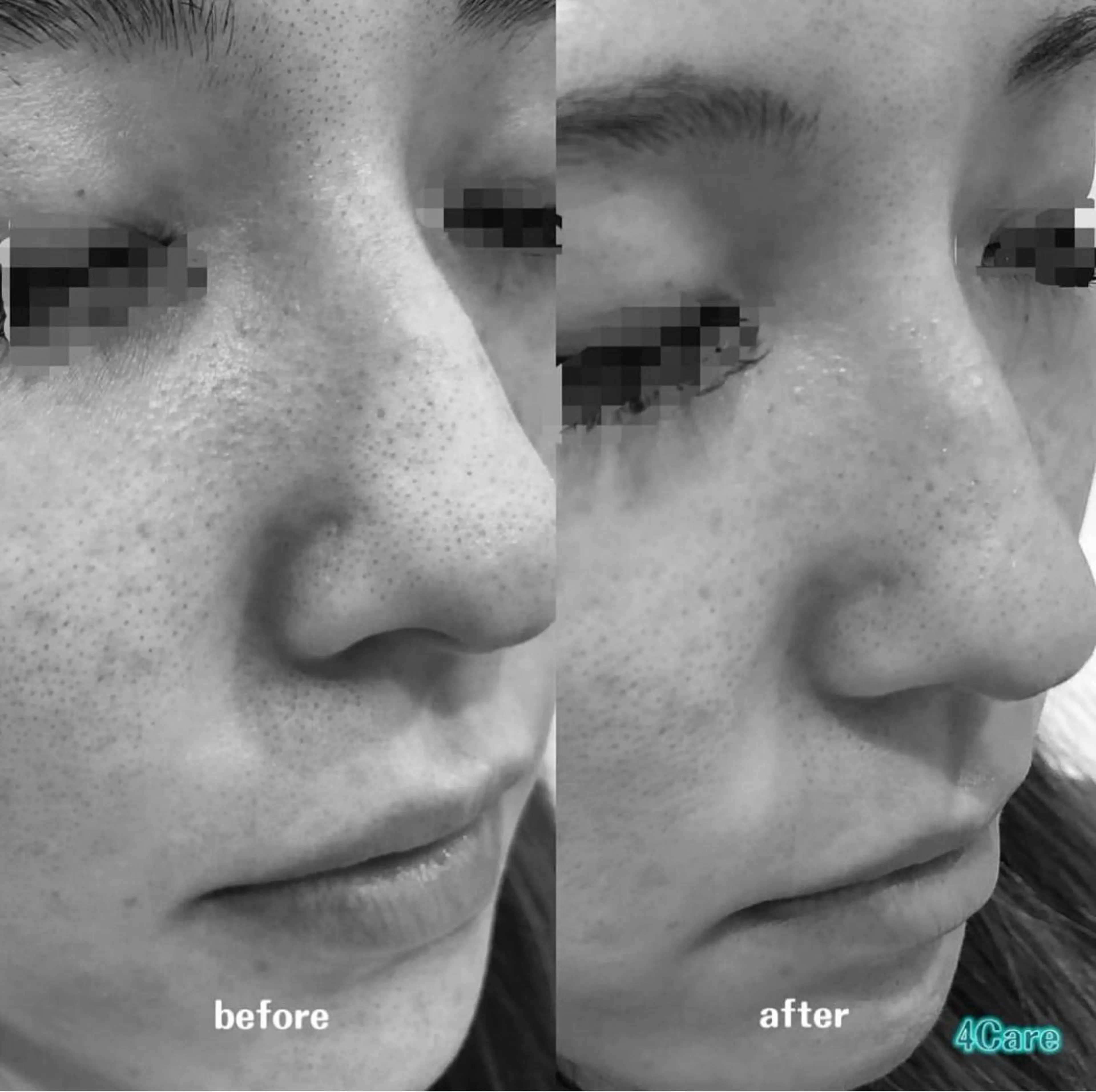 4Care Yのネイルデザイン