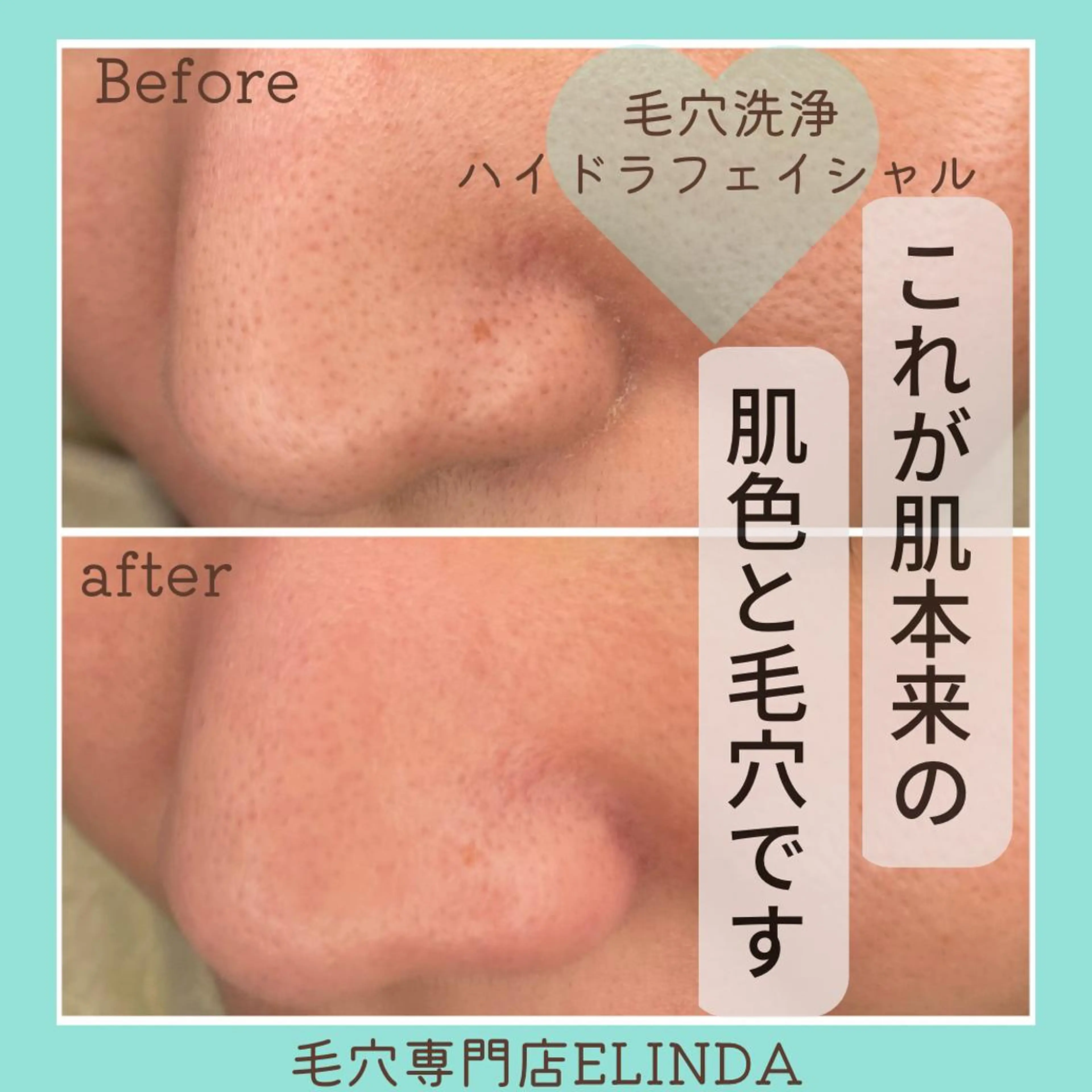 E LINDAのネイルデザイン