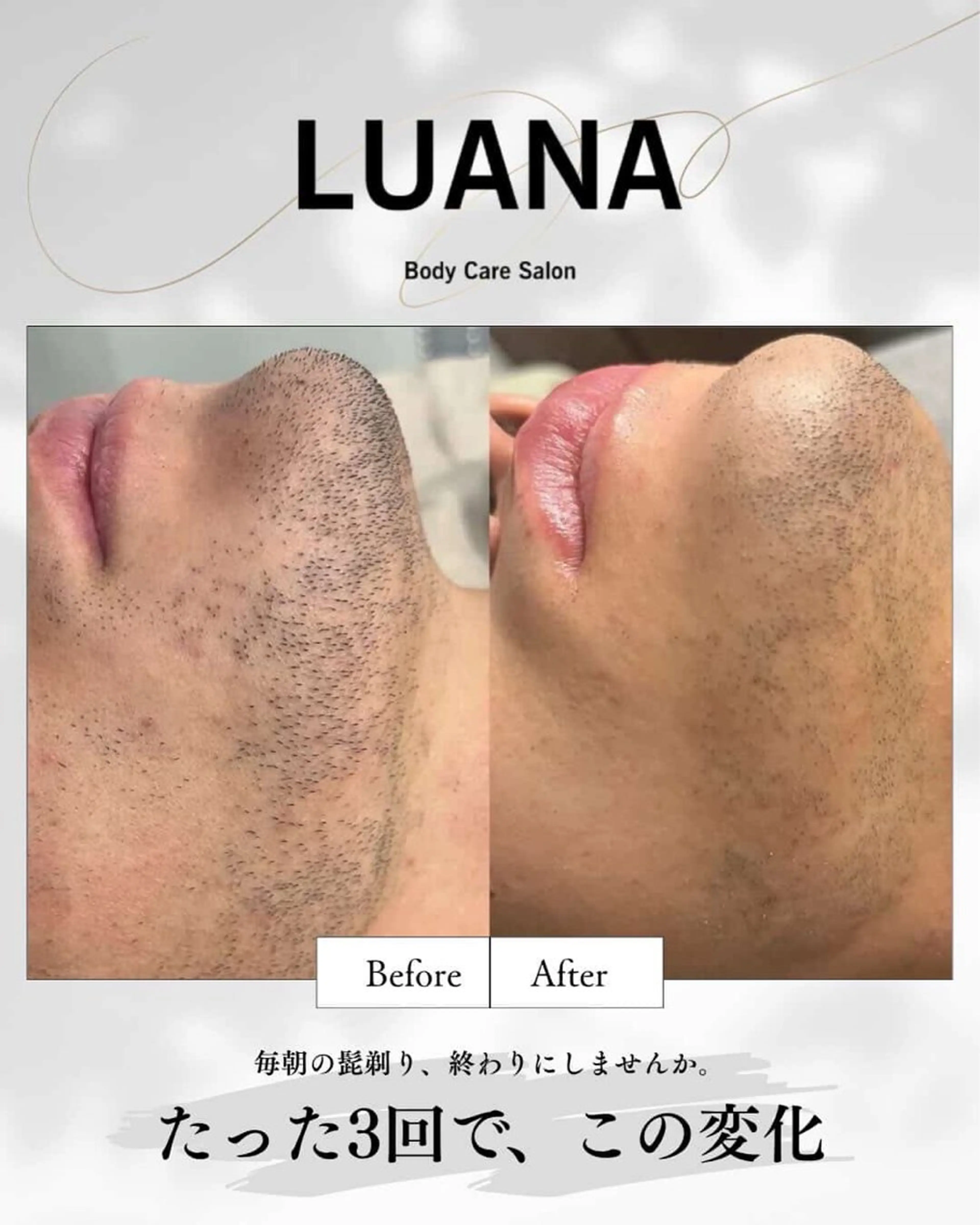 メンズ 脱毛 LUANA/小顔整体 men's脱毛のその他イメージ