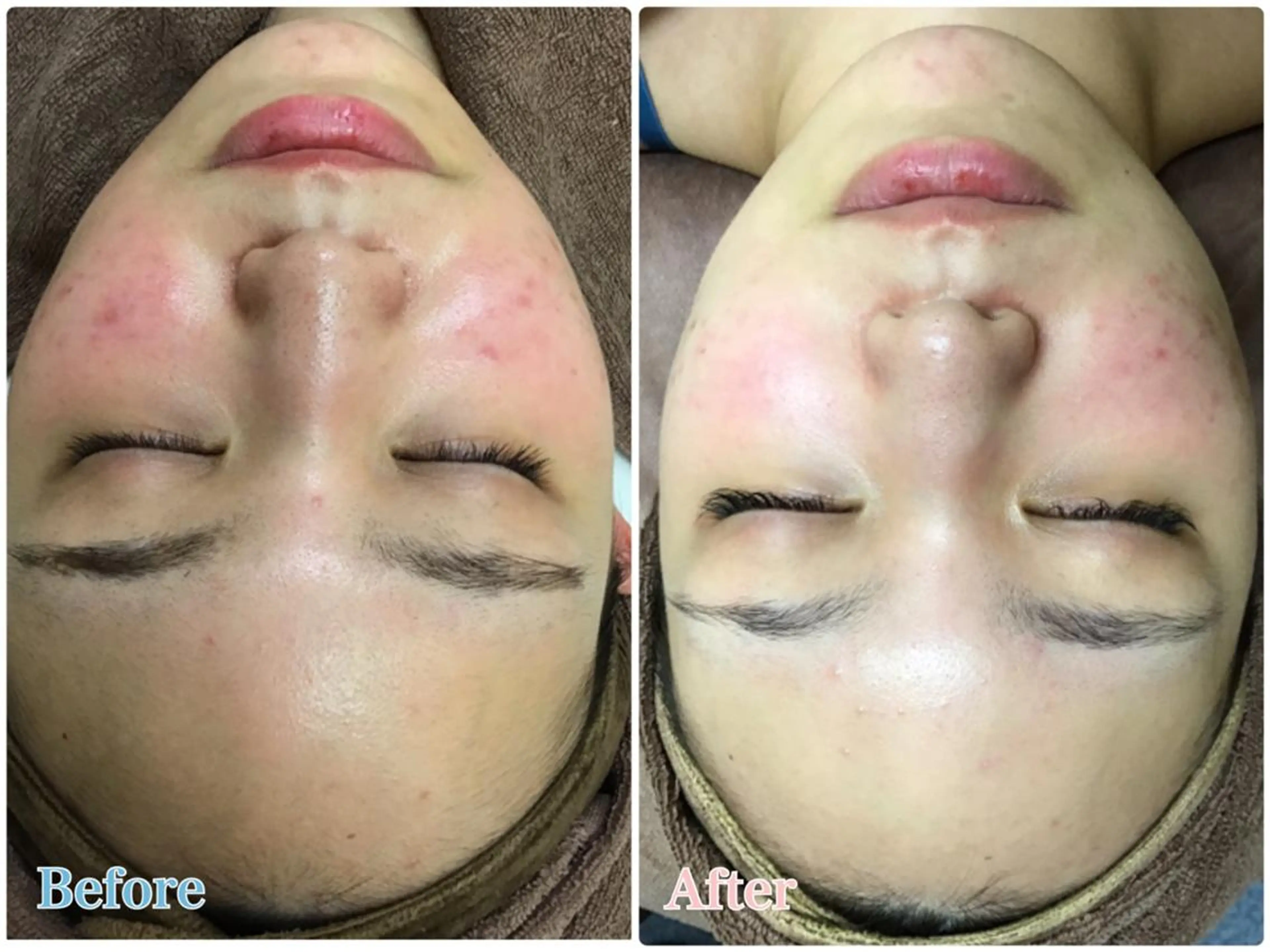 エステティックレイ ビス秋田店　菅野のエステ・リラクイメージ