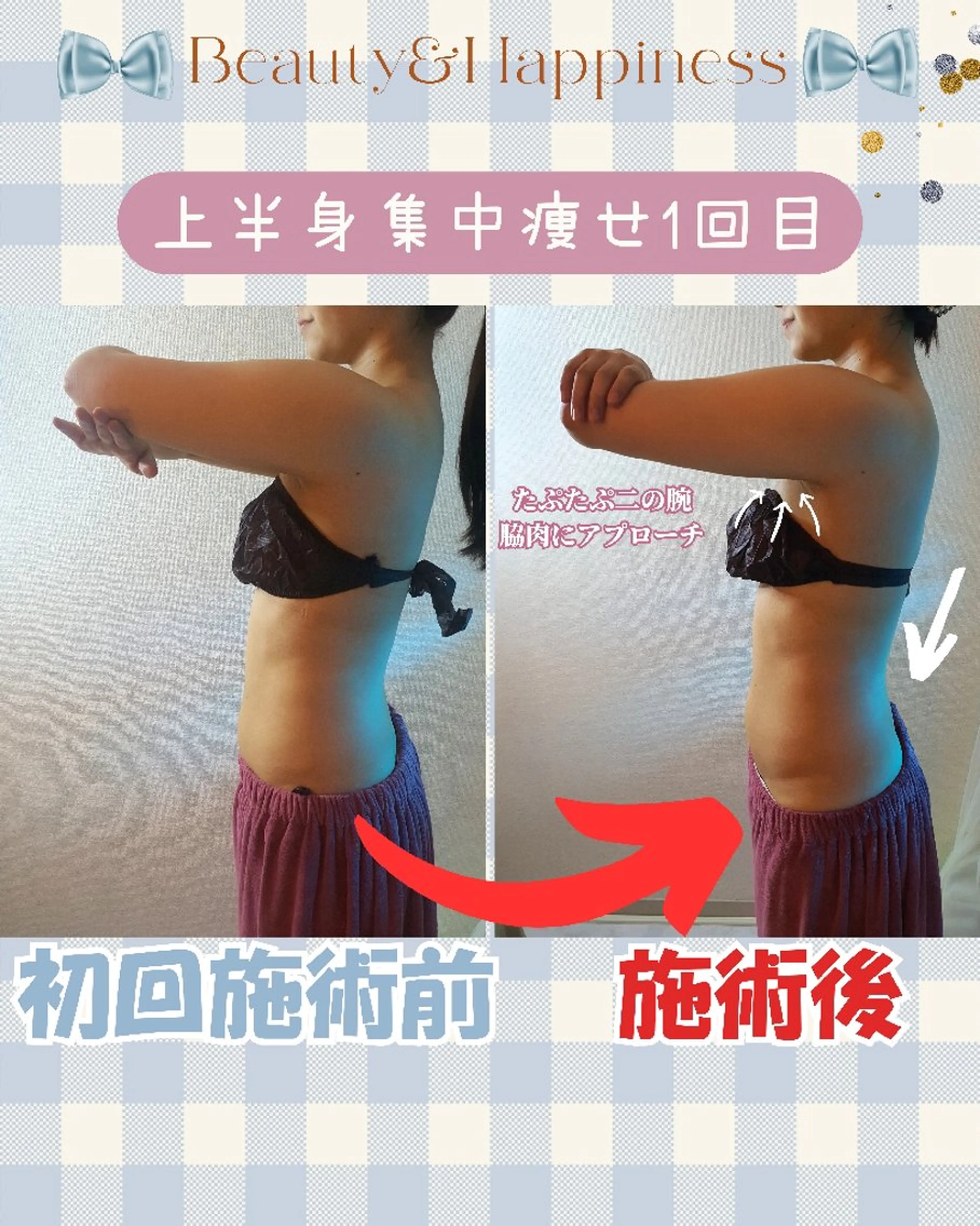 痩身ハーブピーリング 筋膜リリース☆B&Hのエステ・リラクイメージ