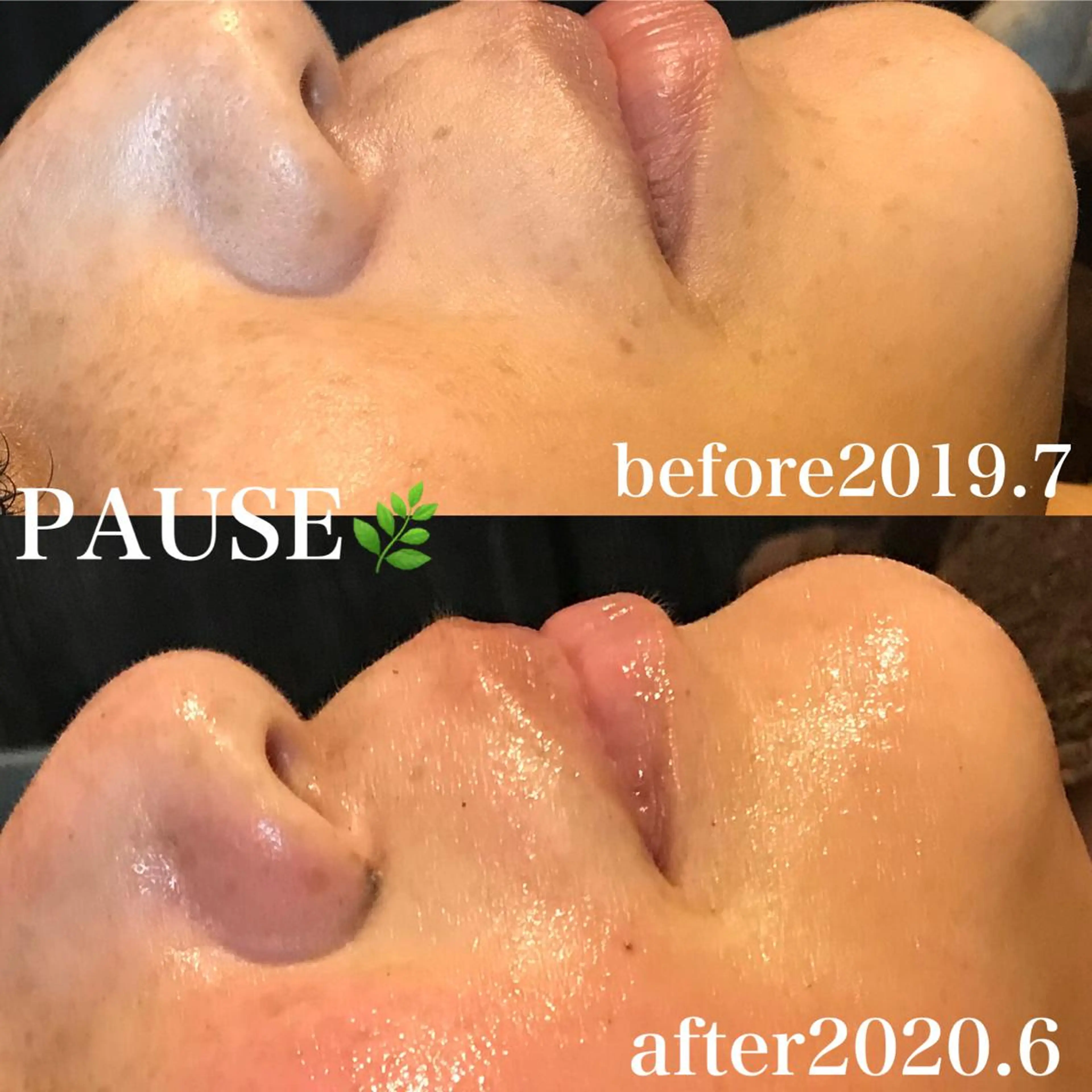 エステ 浜野 恵美のエステ・リラクイメージ