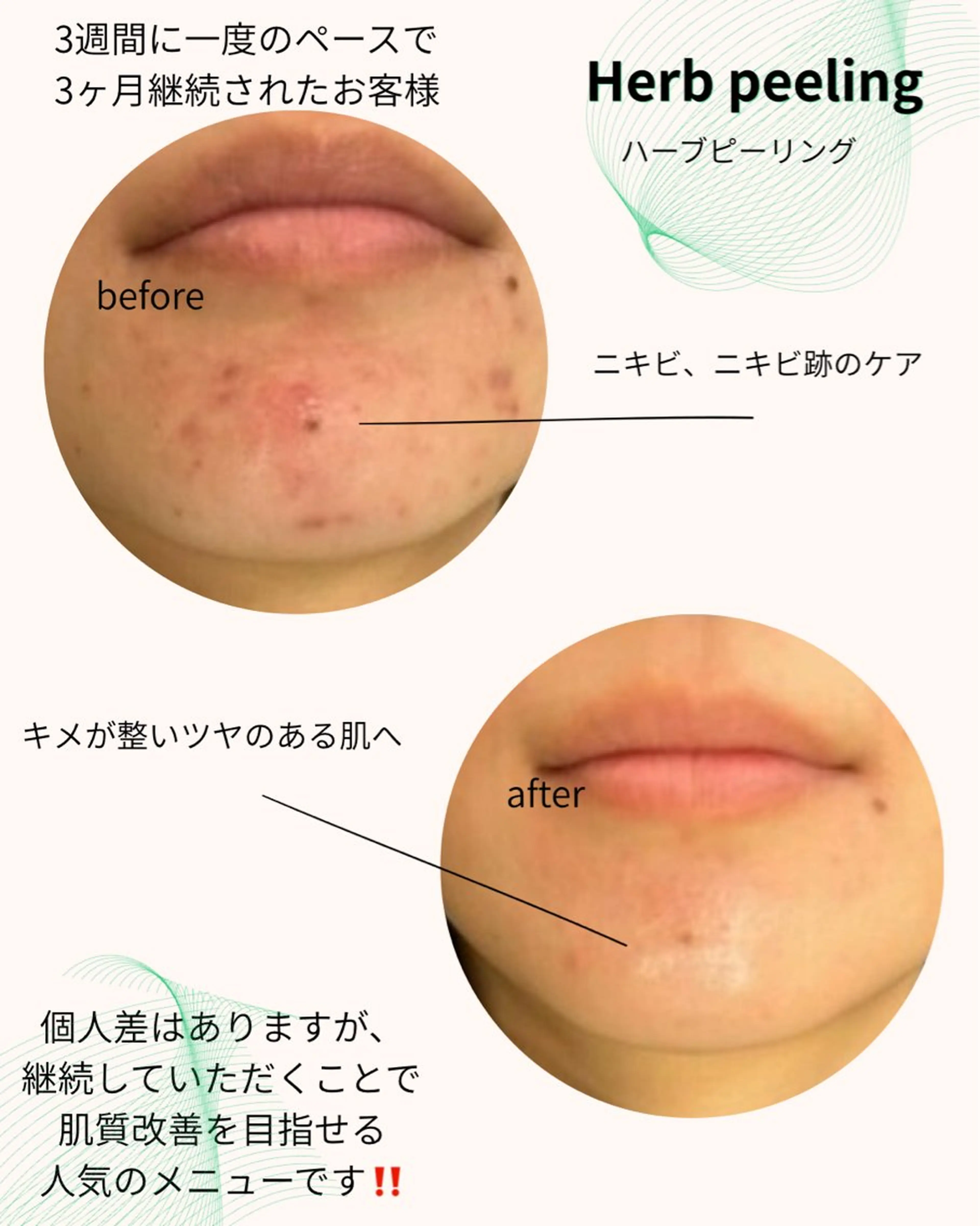 エステ リラク 肌質改善サロン réposのその他イメージ