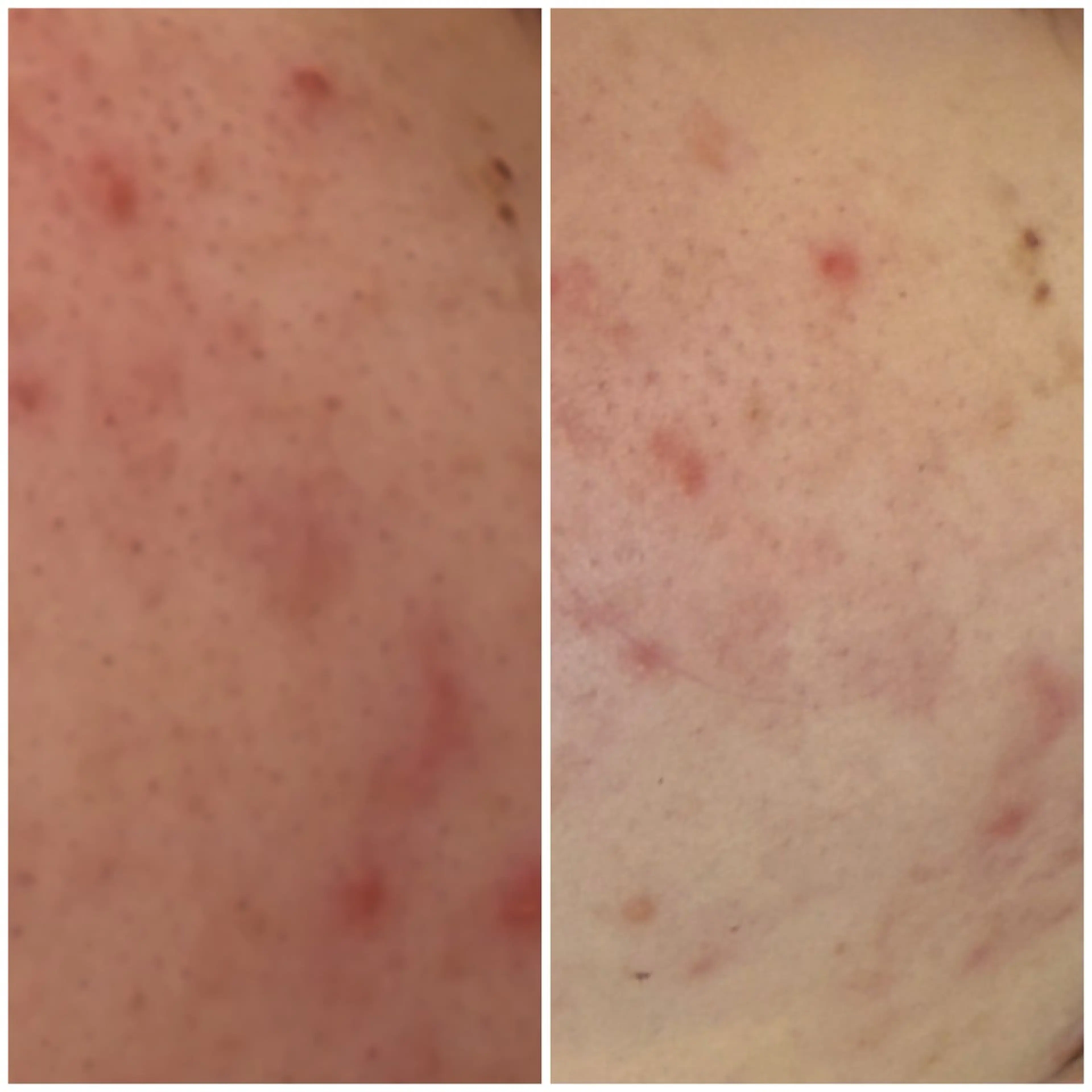 エステ ルアラ エステのエステ・リラクイメージ