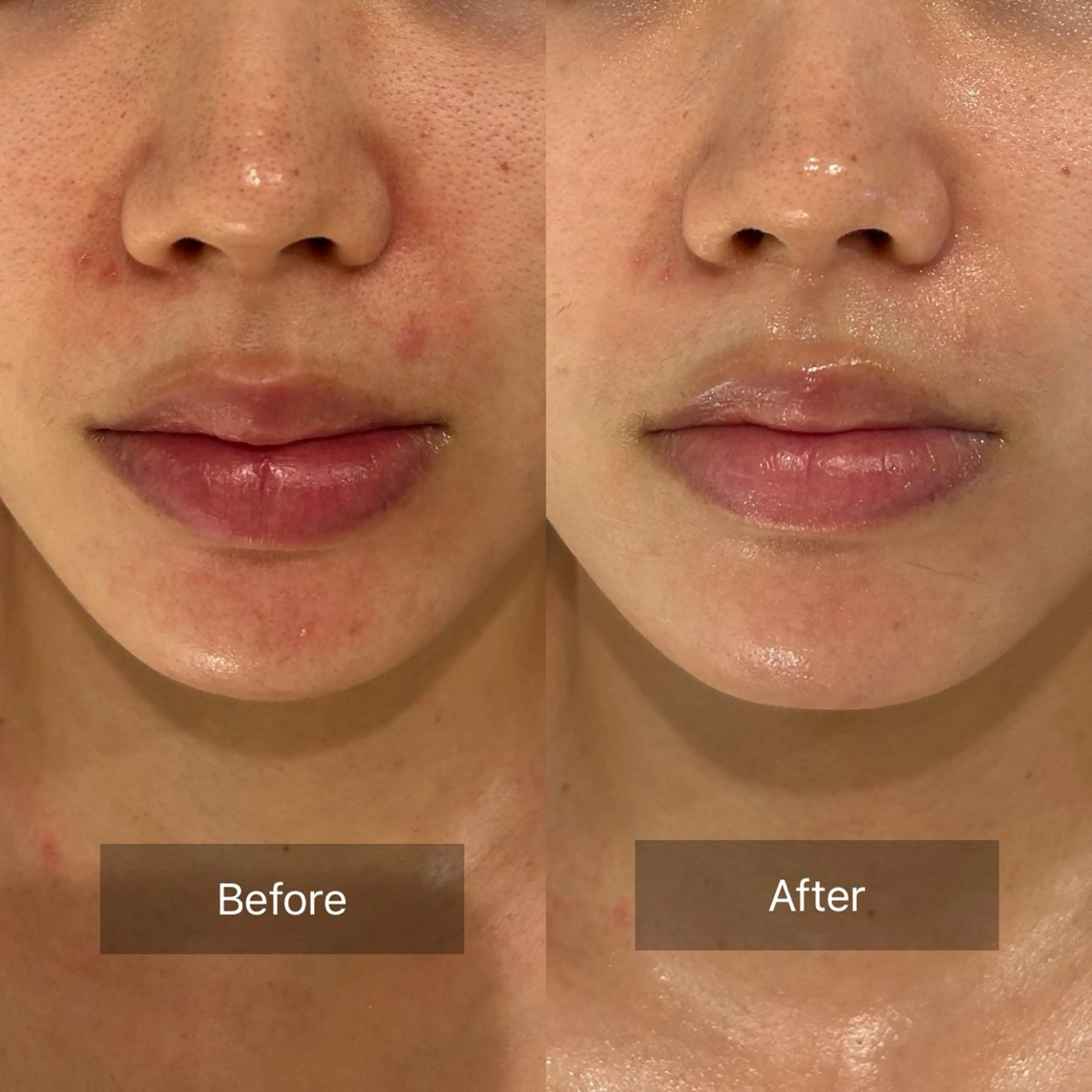 mine.mマインエム所属・mine.mi マインエムのエステ・リラクイメージ