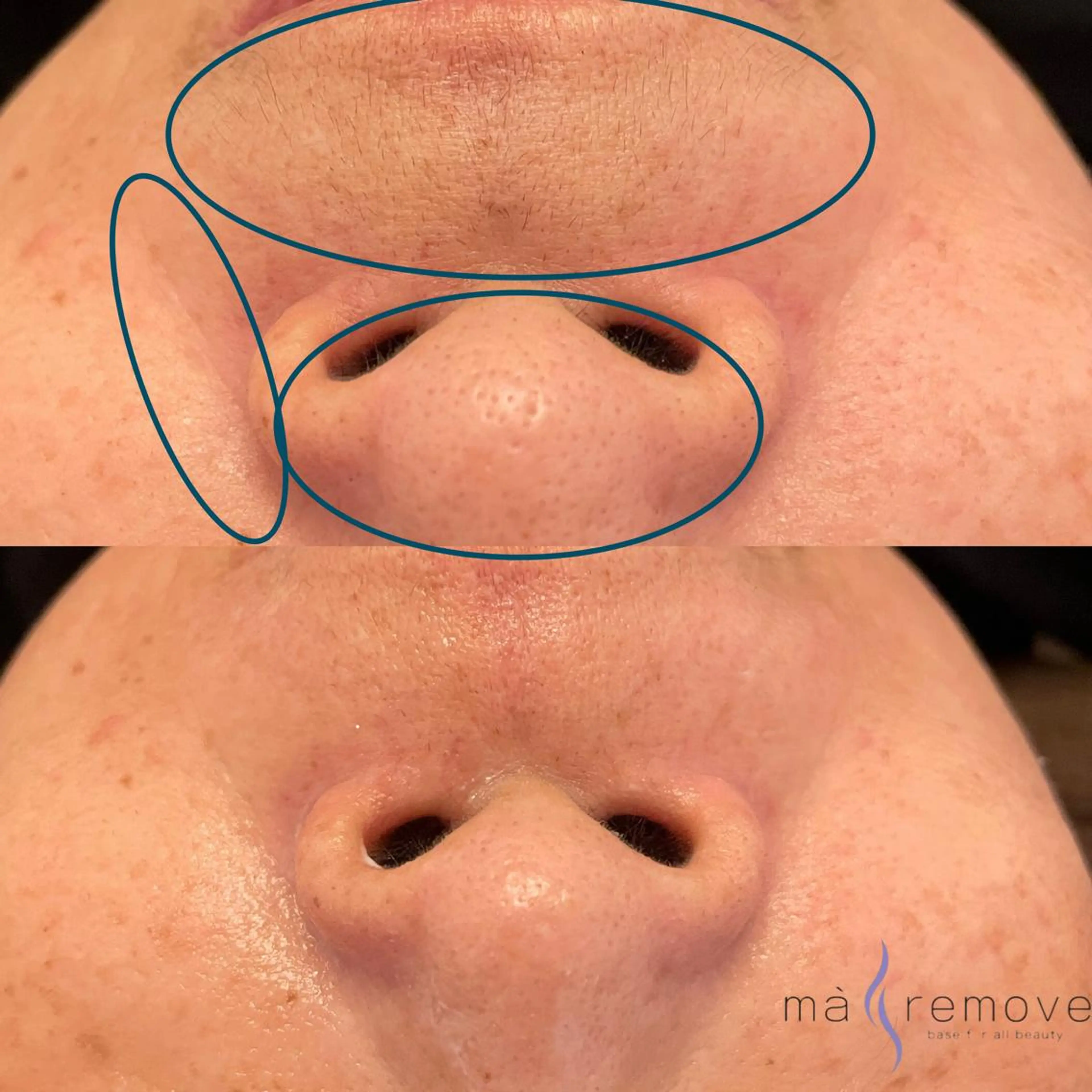 amu nail. RINAのネイルデザイン