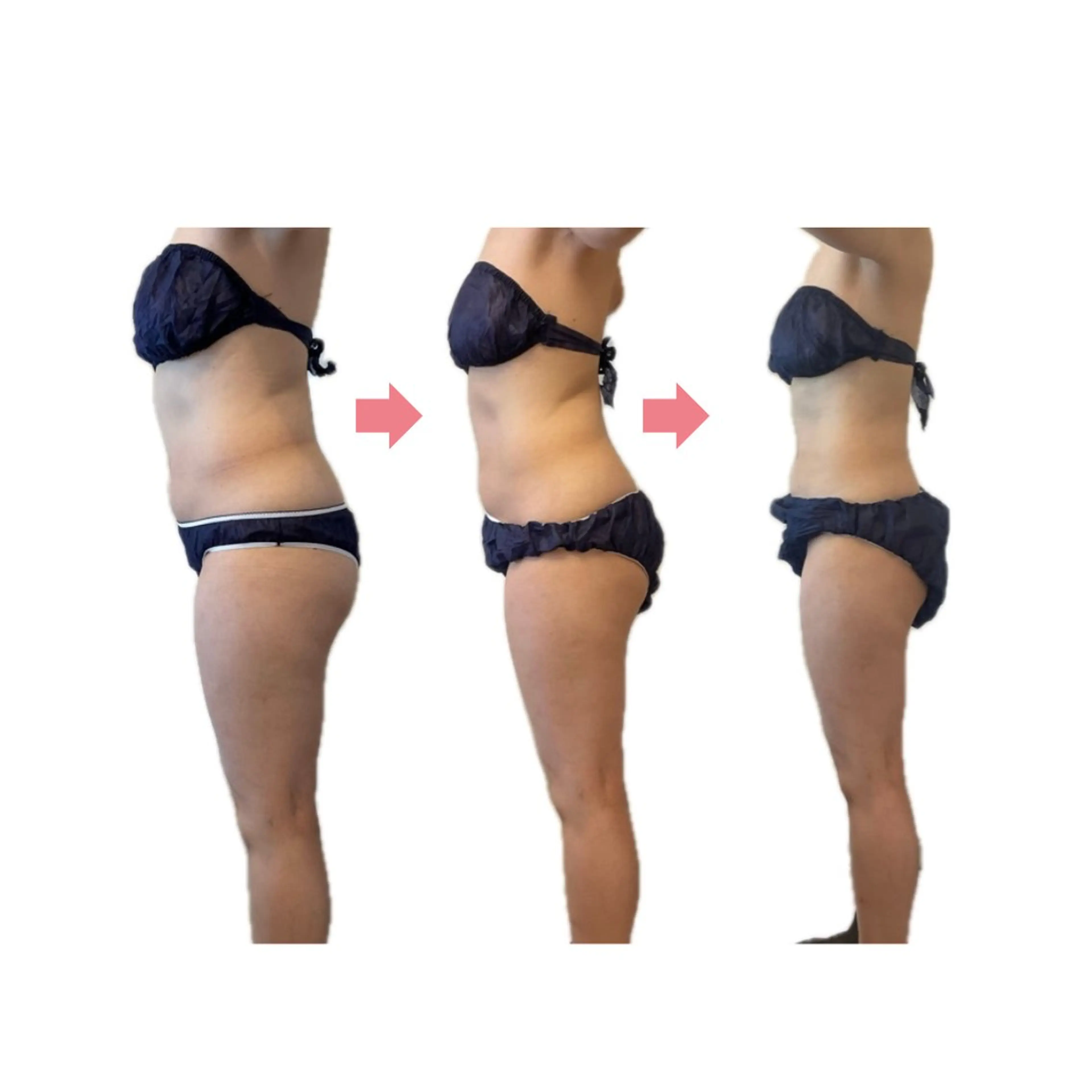 エステ リラク 痩身専門サロン Coralのエステ・リラクイメージ