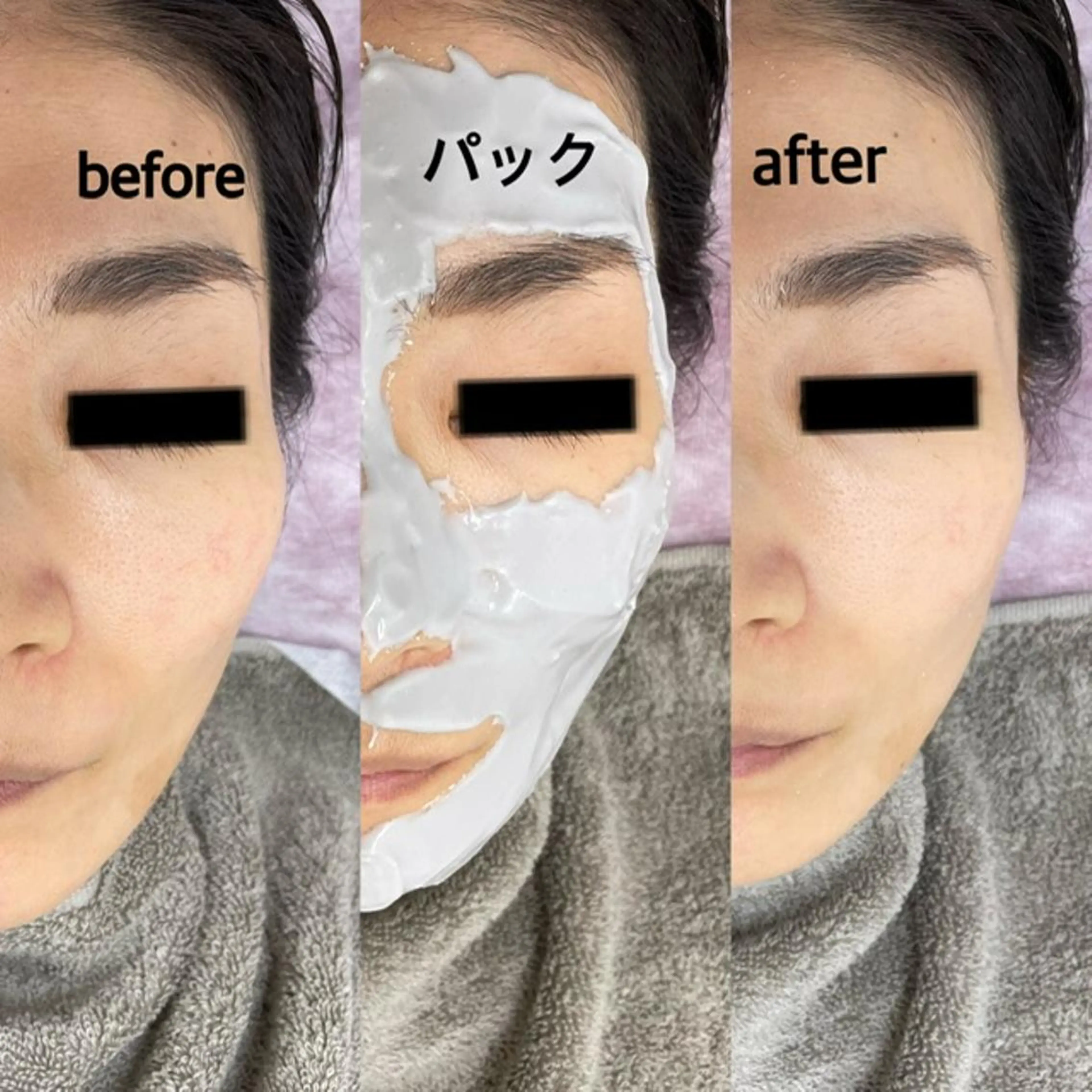 エステ 肌ケア＆毛穴洗浄 Cheri/女性専用のエステ・リラクイメージ