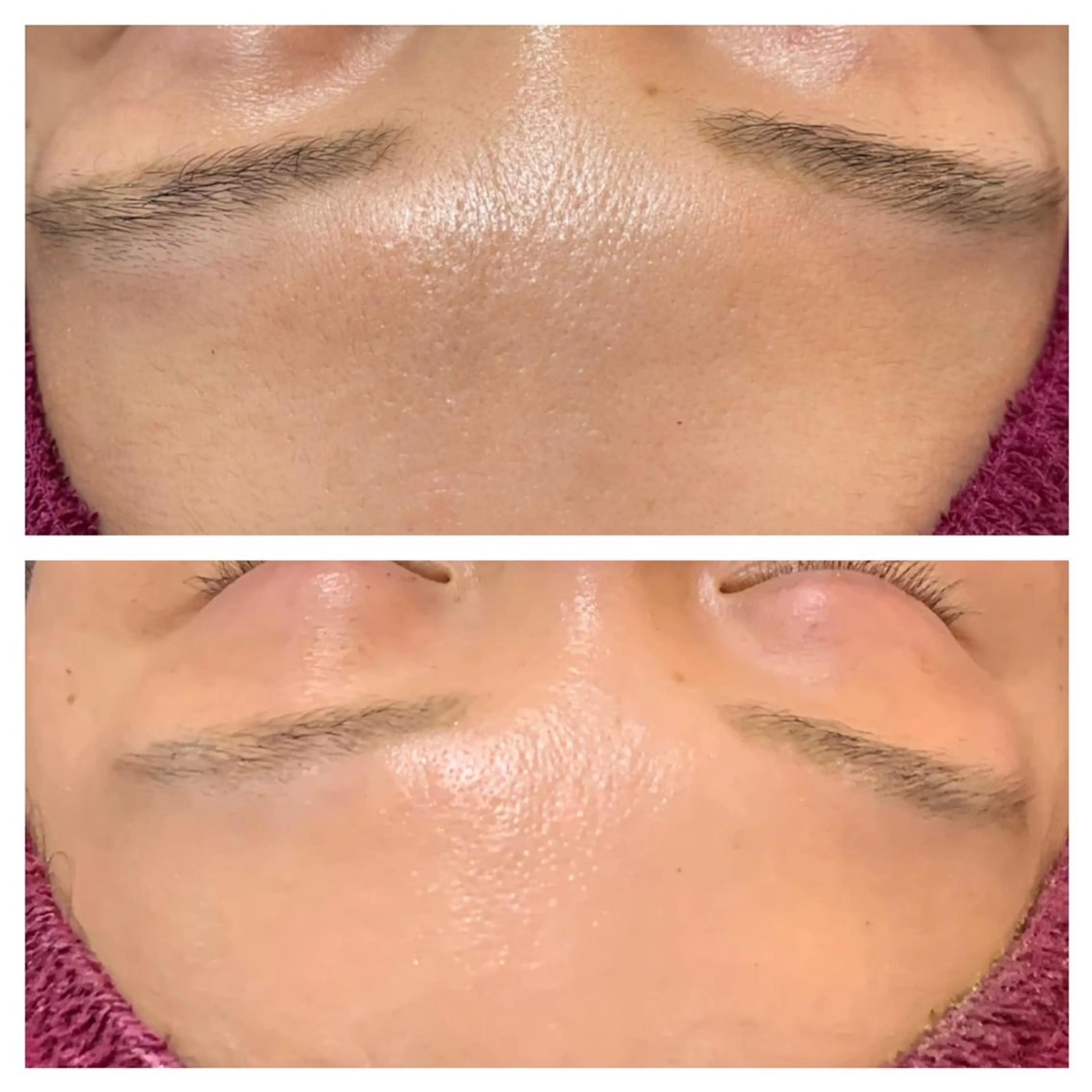 【REVIハーブピーリング】話題の陶肌トリートメント！！お試し体験【オプション無】現金のみの写真