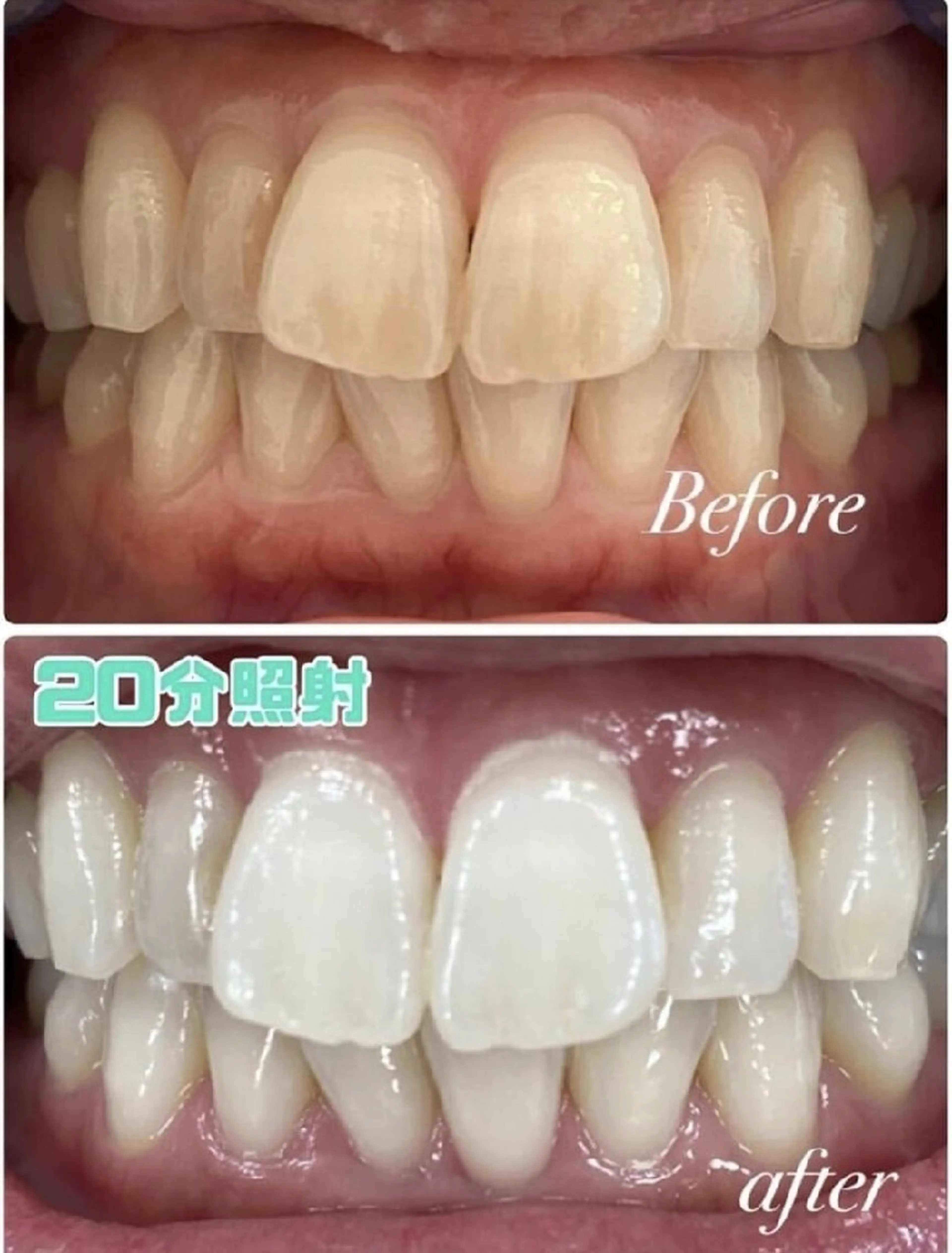 【会員様】回数券のご予約の写真