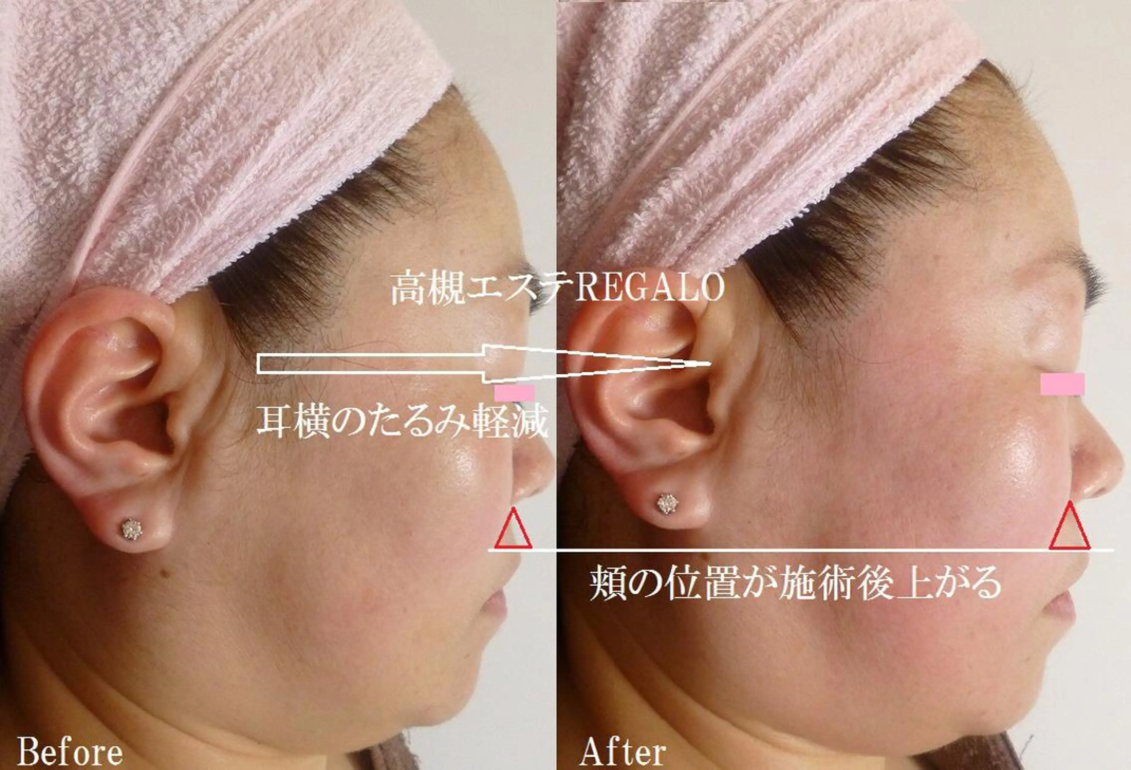 エステ 矢野 さやかのエステ・リラクイメージ