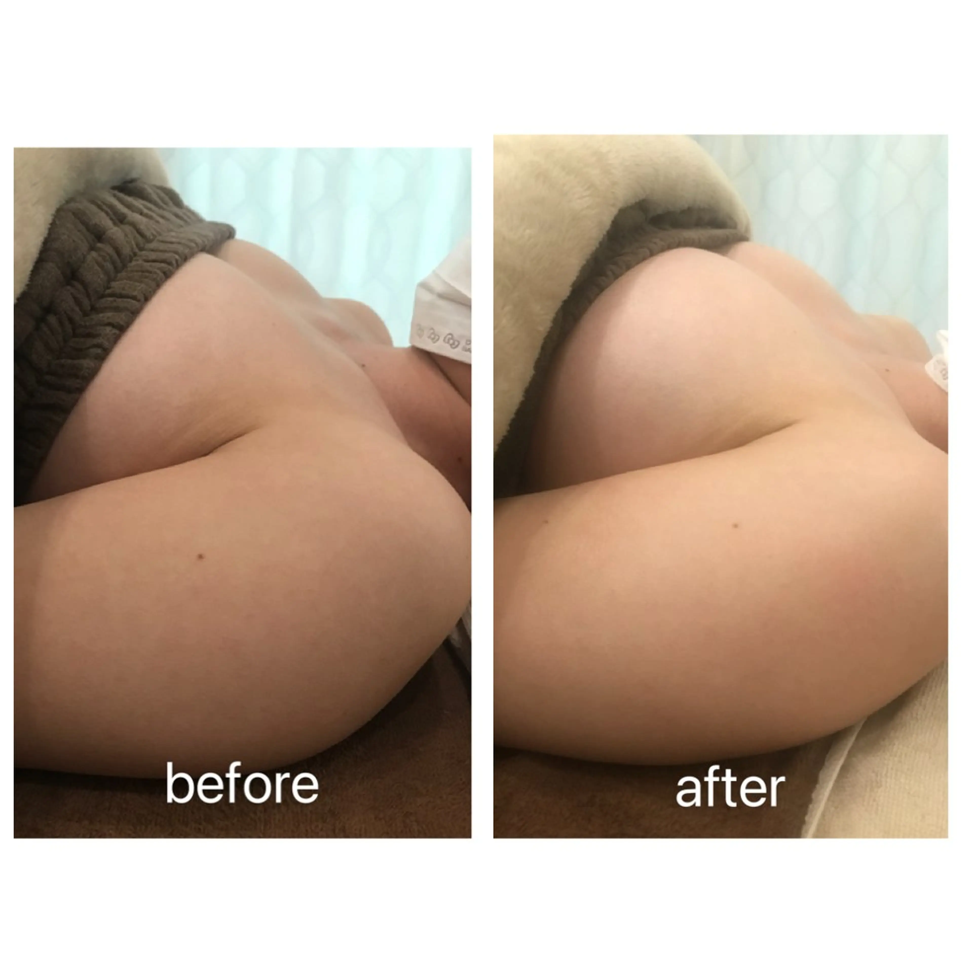 Rene 慢性疲労ケアサロンのエステ・リラクイメージ