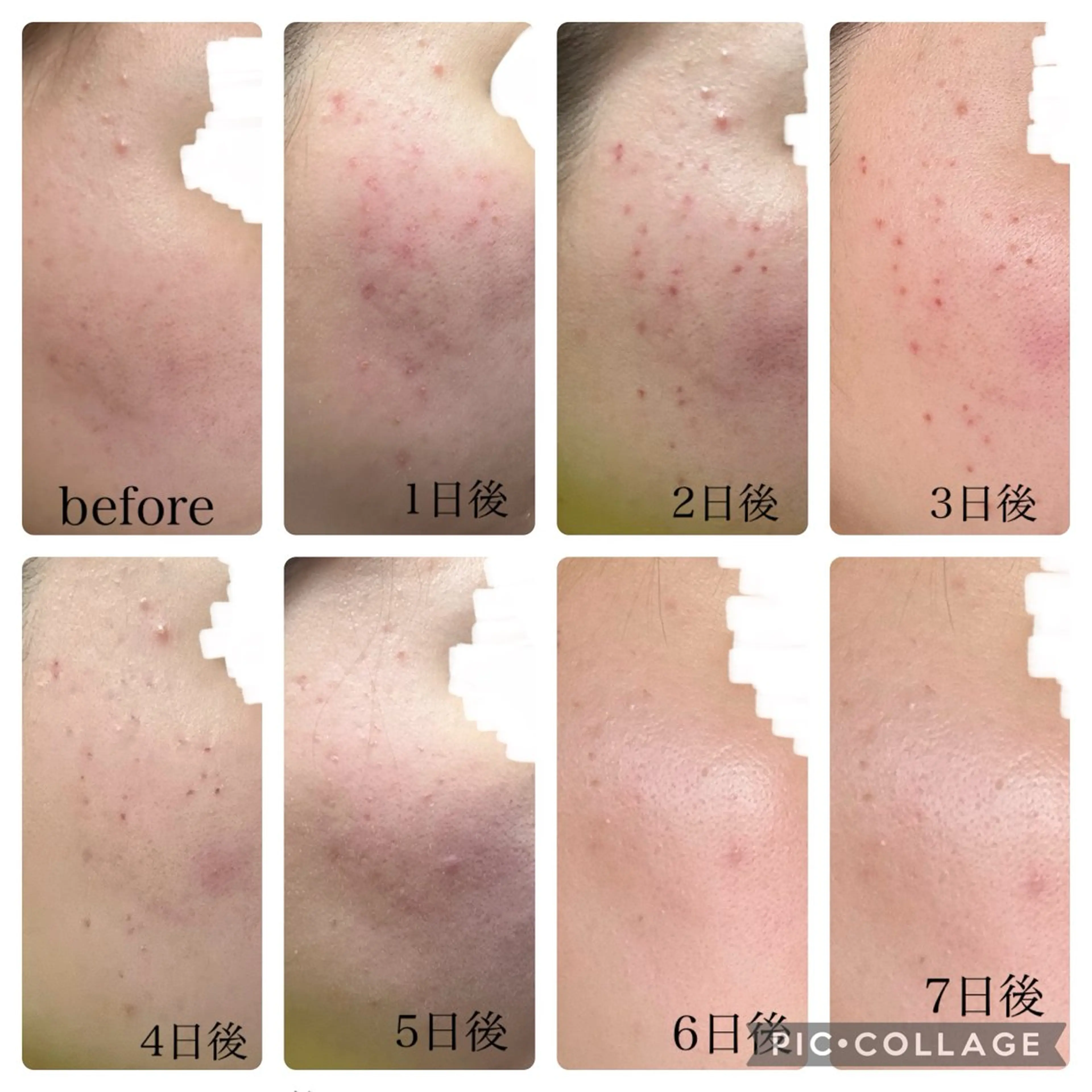 エステ 伊藤 稚菜のエステ・リラクイメージ