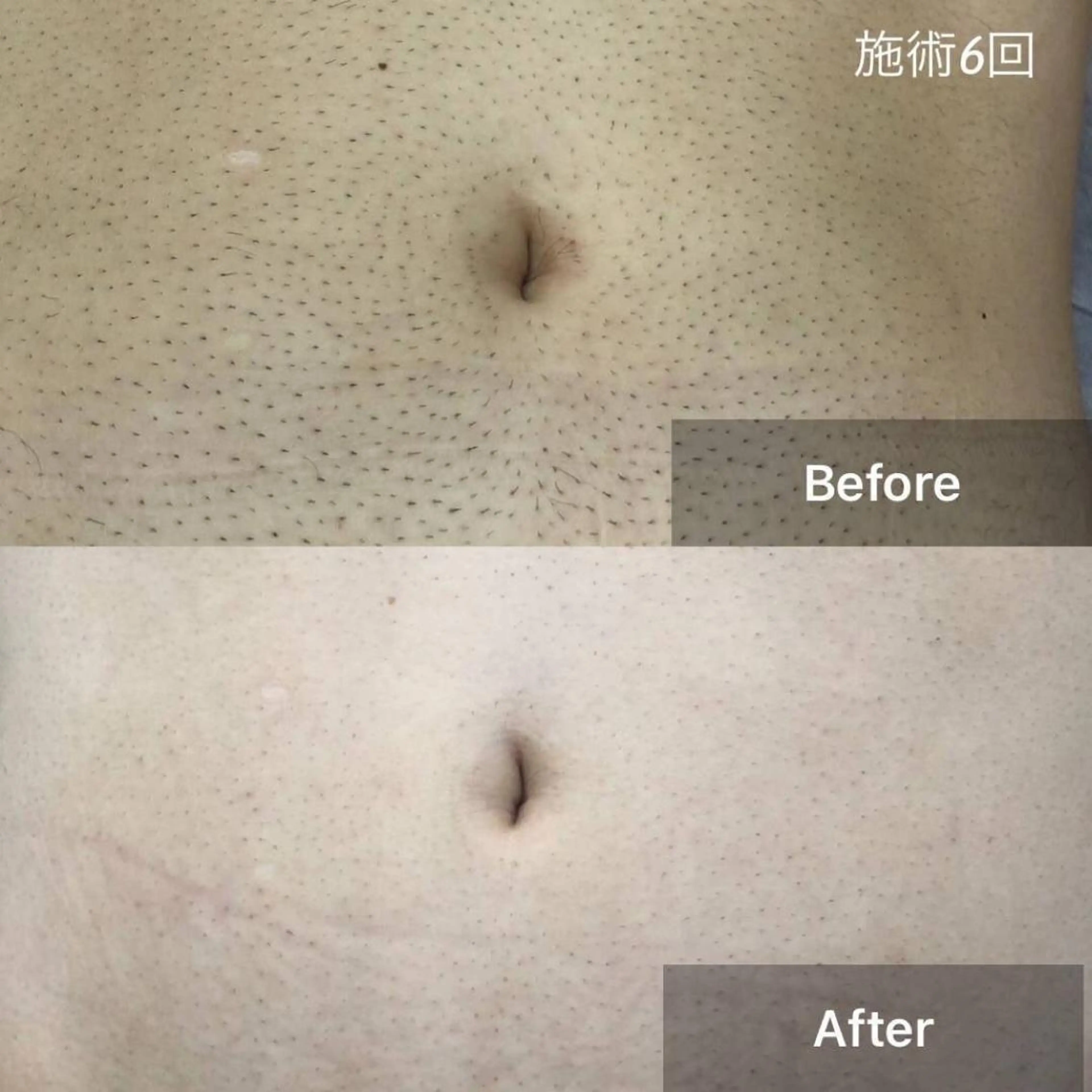 痩身/毛穴洗浄/脱毛 アルカンジュのエステ・リラクイメージ