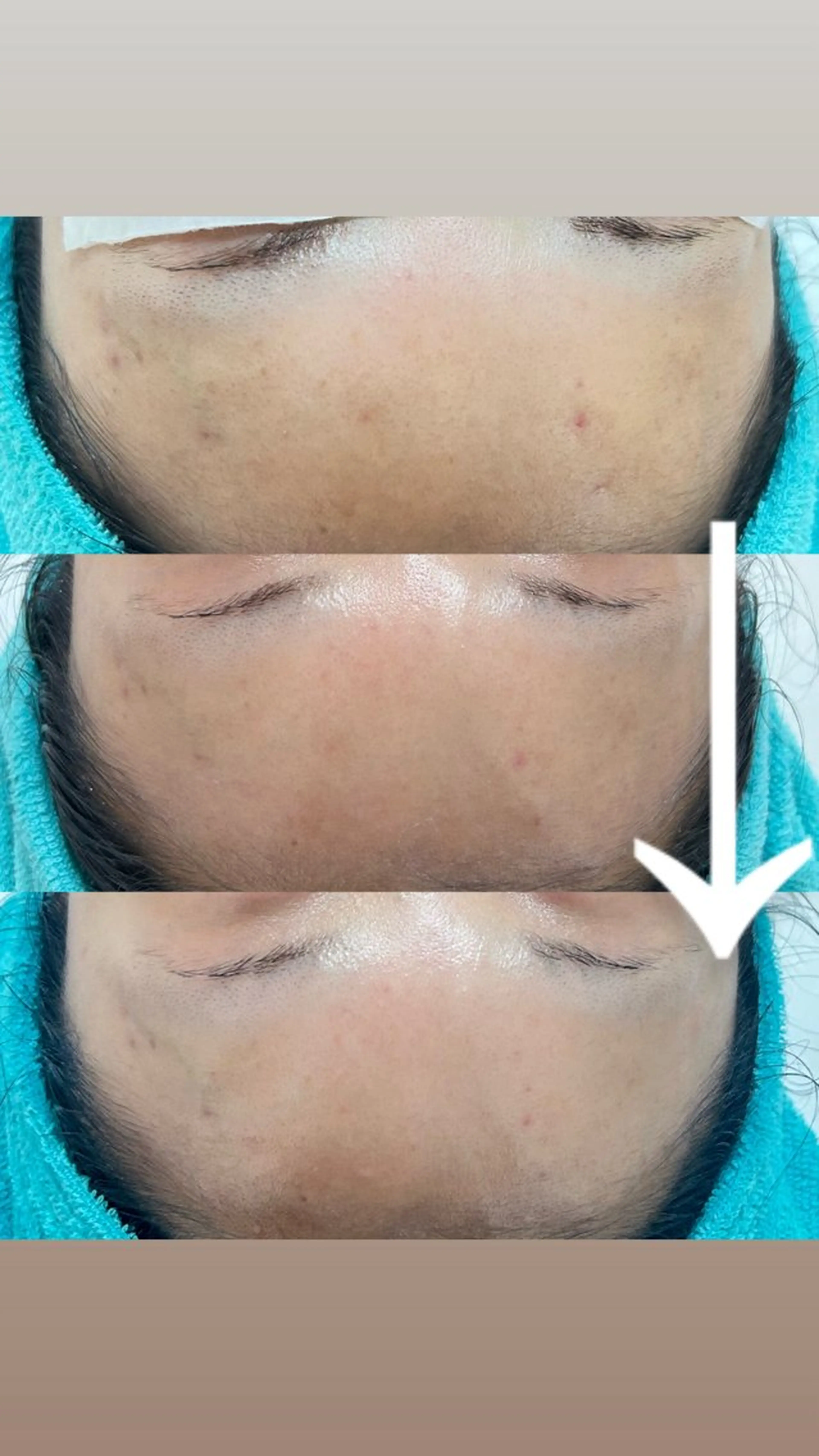 エステ Be Charm 山﨑のエステ・リラクイメージ