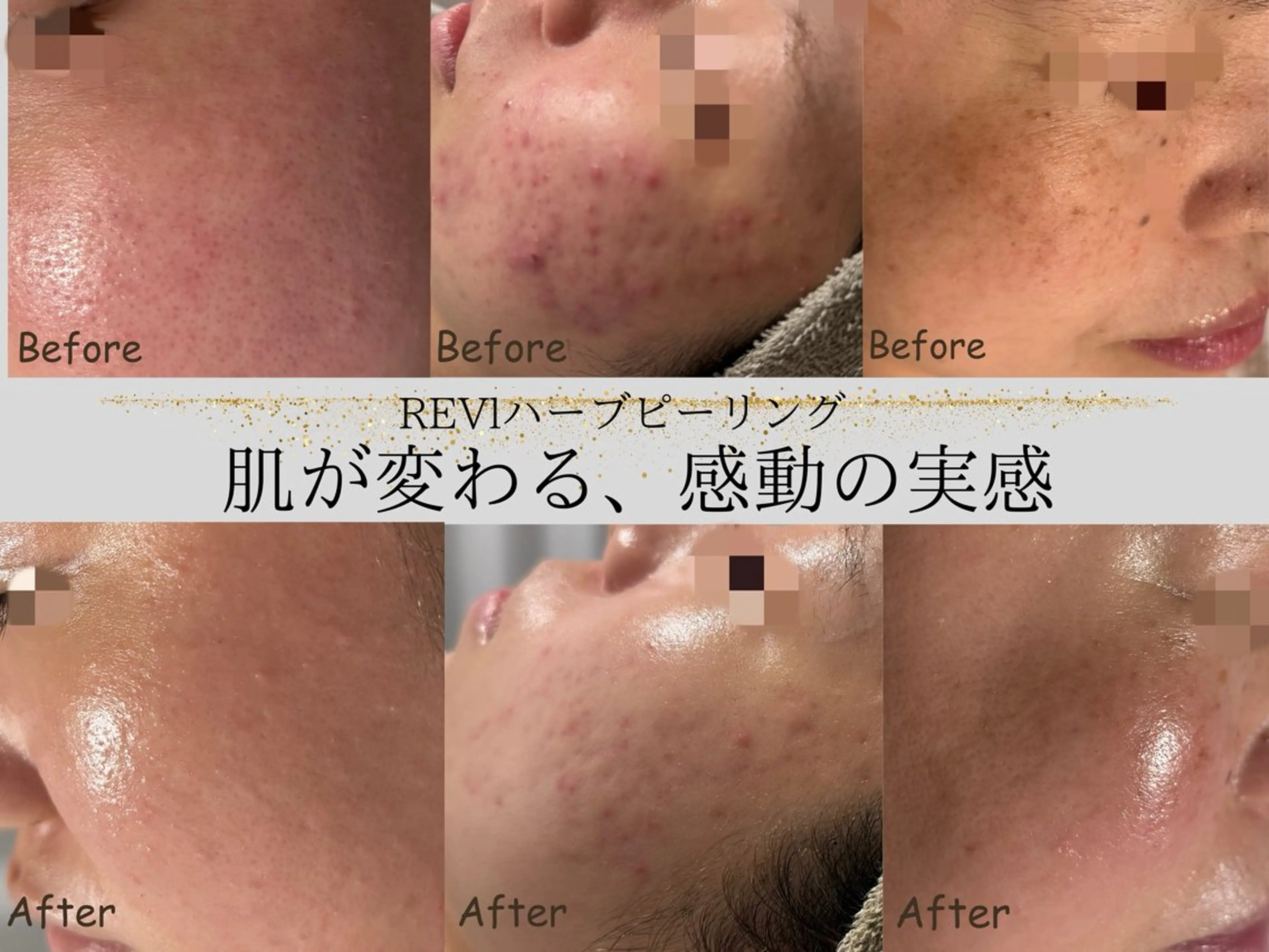 エステ リラク lumi riseのエステ・リラクイメージ