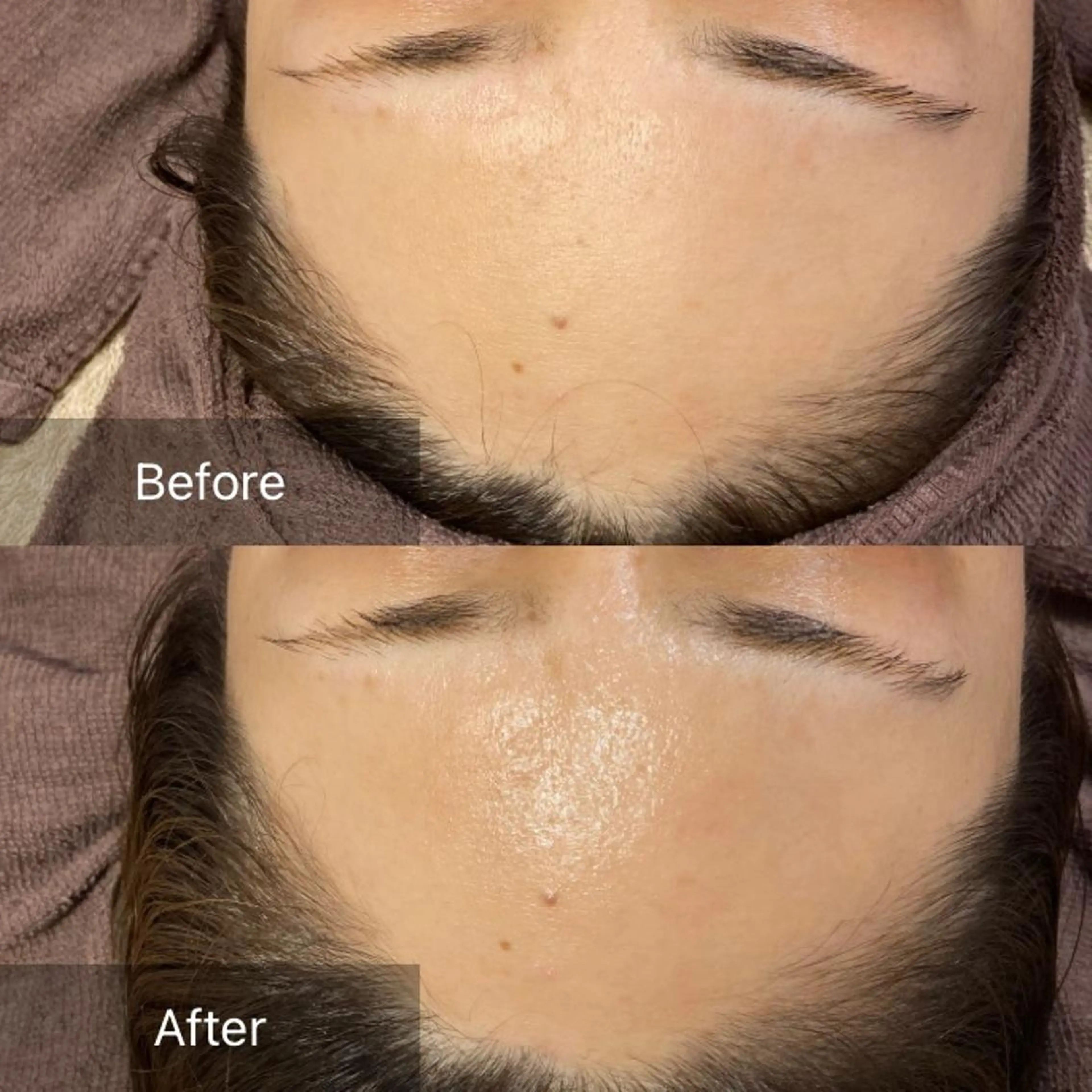 脱毛 産毛専門店 Bittoのエステ・リラクイメージ