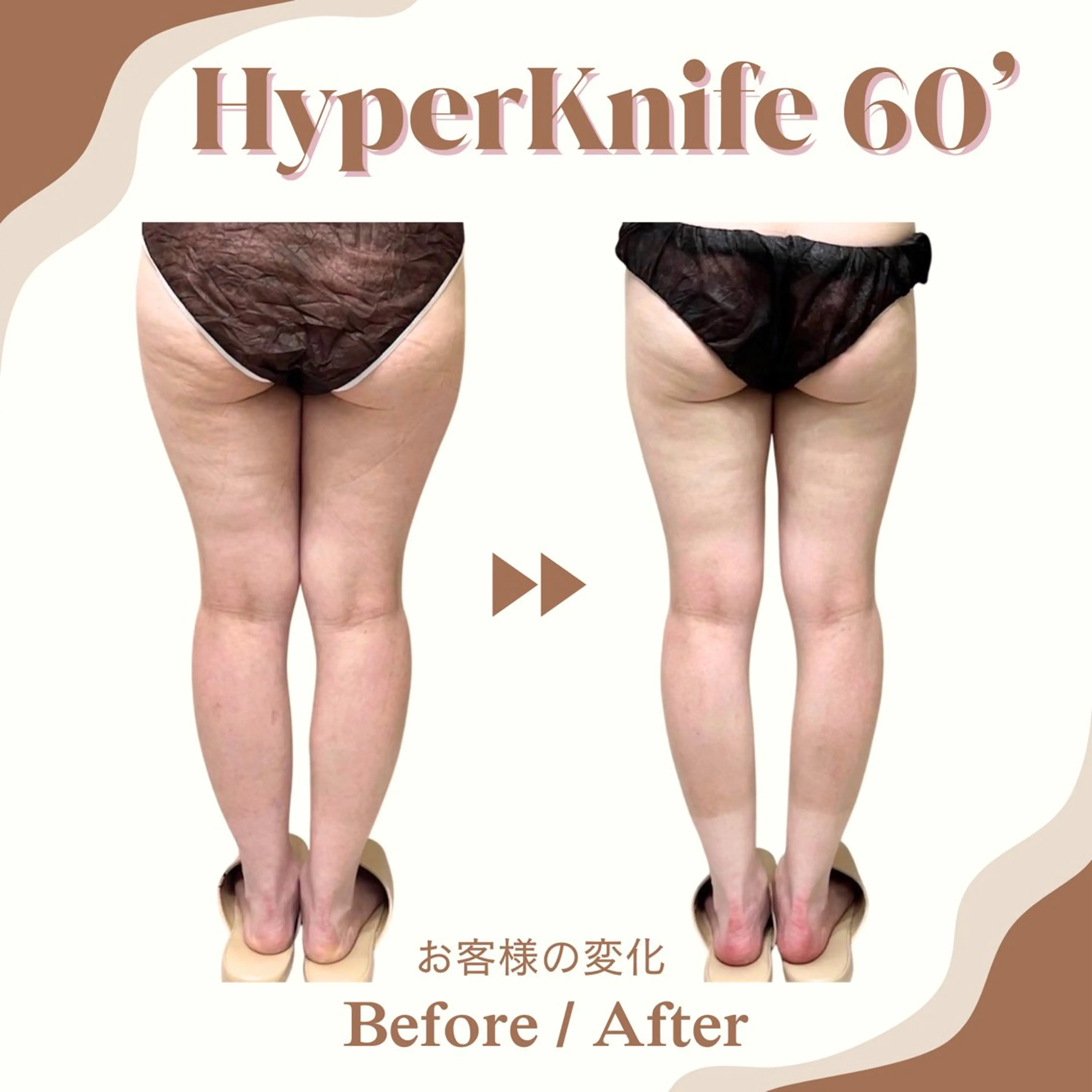 《ミニモ学割》U24 60分ハイパーナイフ◇上半身or下半身の写真