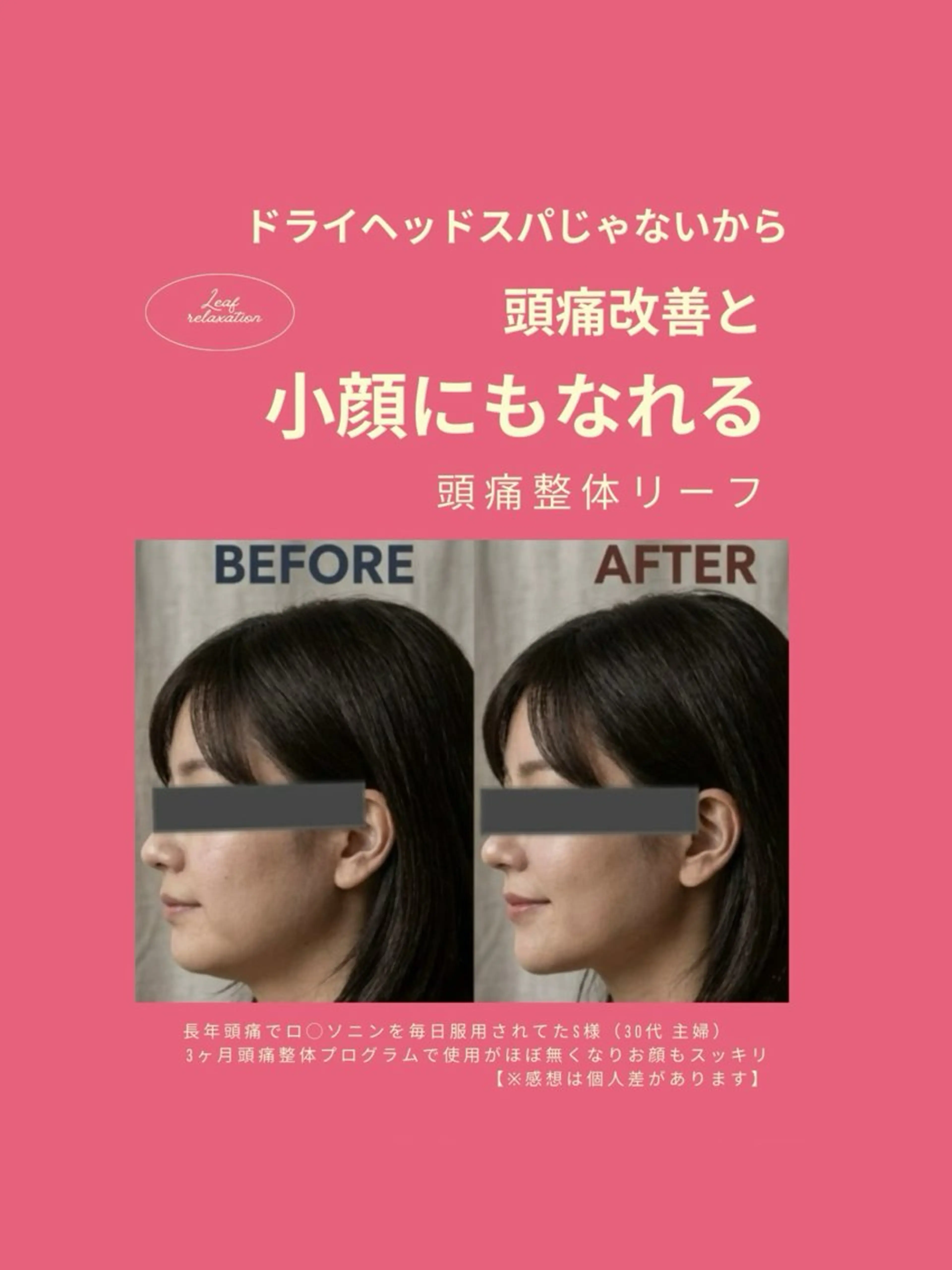 頭痛専門店 リーフ　　武蔵浦和店のその他イメージ