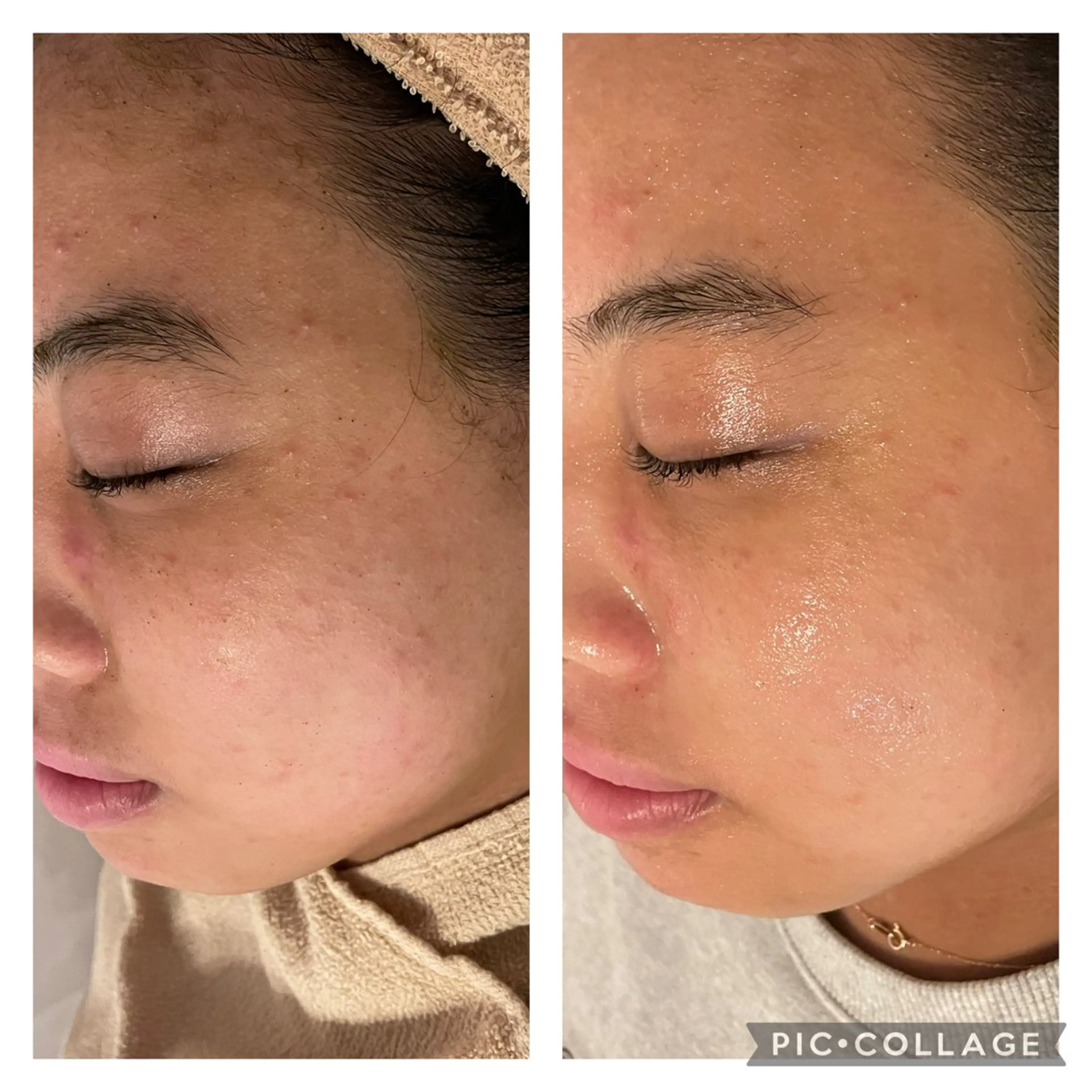 エステ 毛穴改善サロン d'Alba大阪住吉のエステ・リラクイメージ