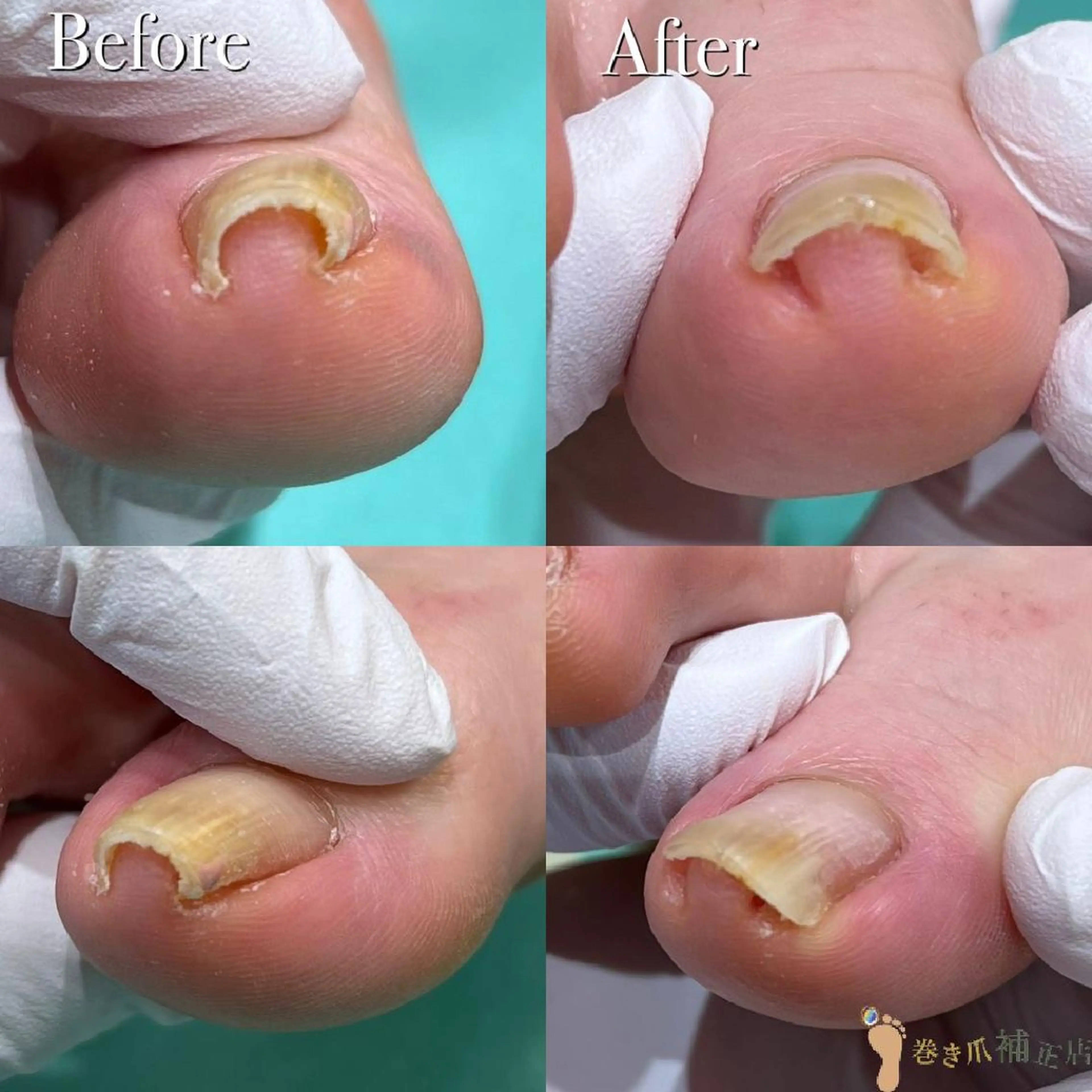 東京巻き爪アカデミー所属・東京巻き爪 アカデミーのエステ・リラクイメージ