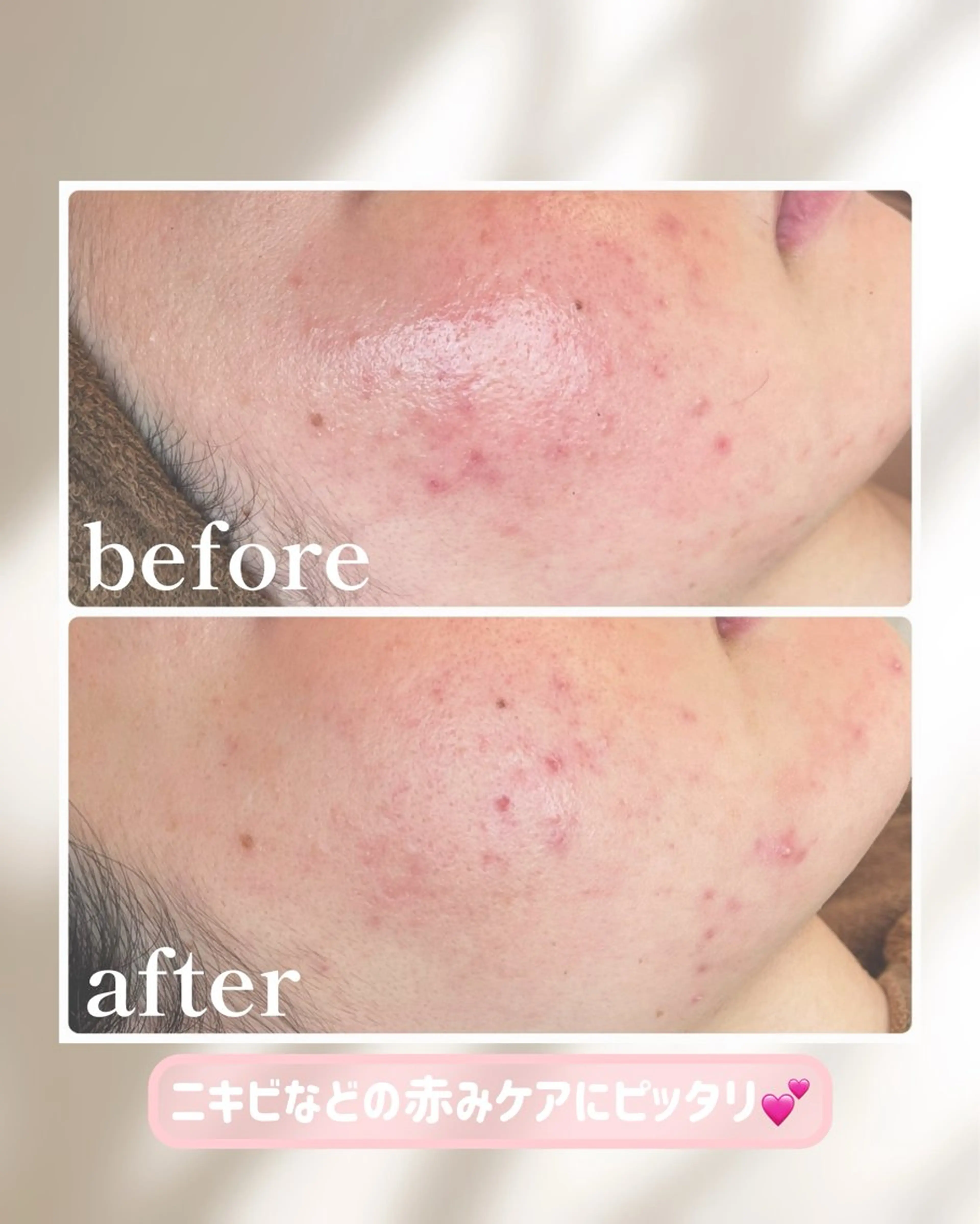 その他 lulularico Yuのエステ・リラクイメージ