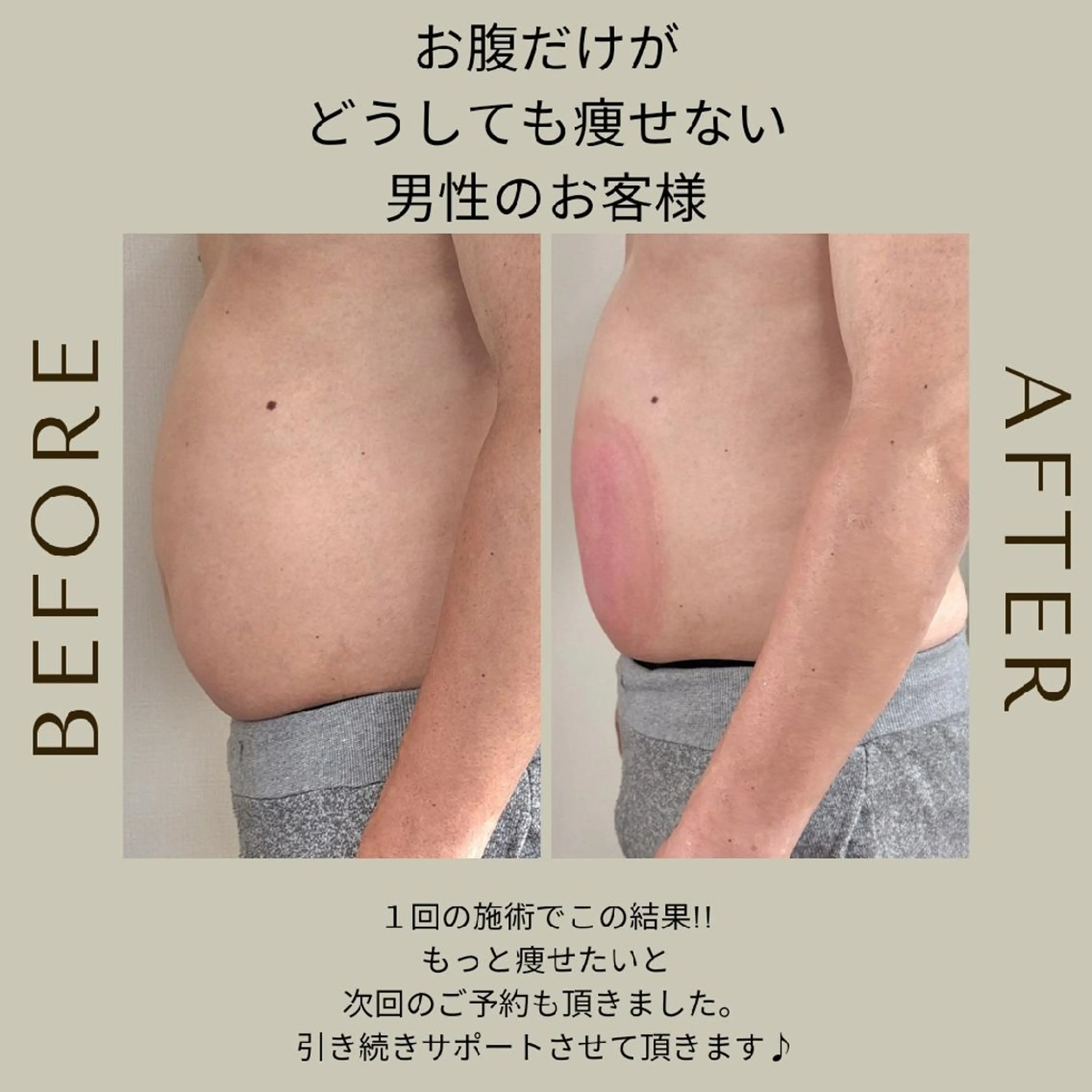 脂肪冷却・脱毛サロン coconoix のエステ・リラクイメージ