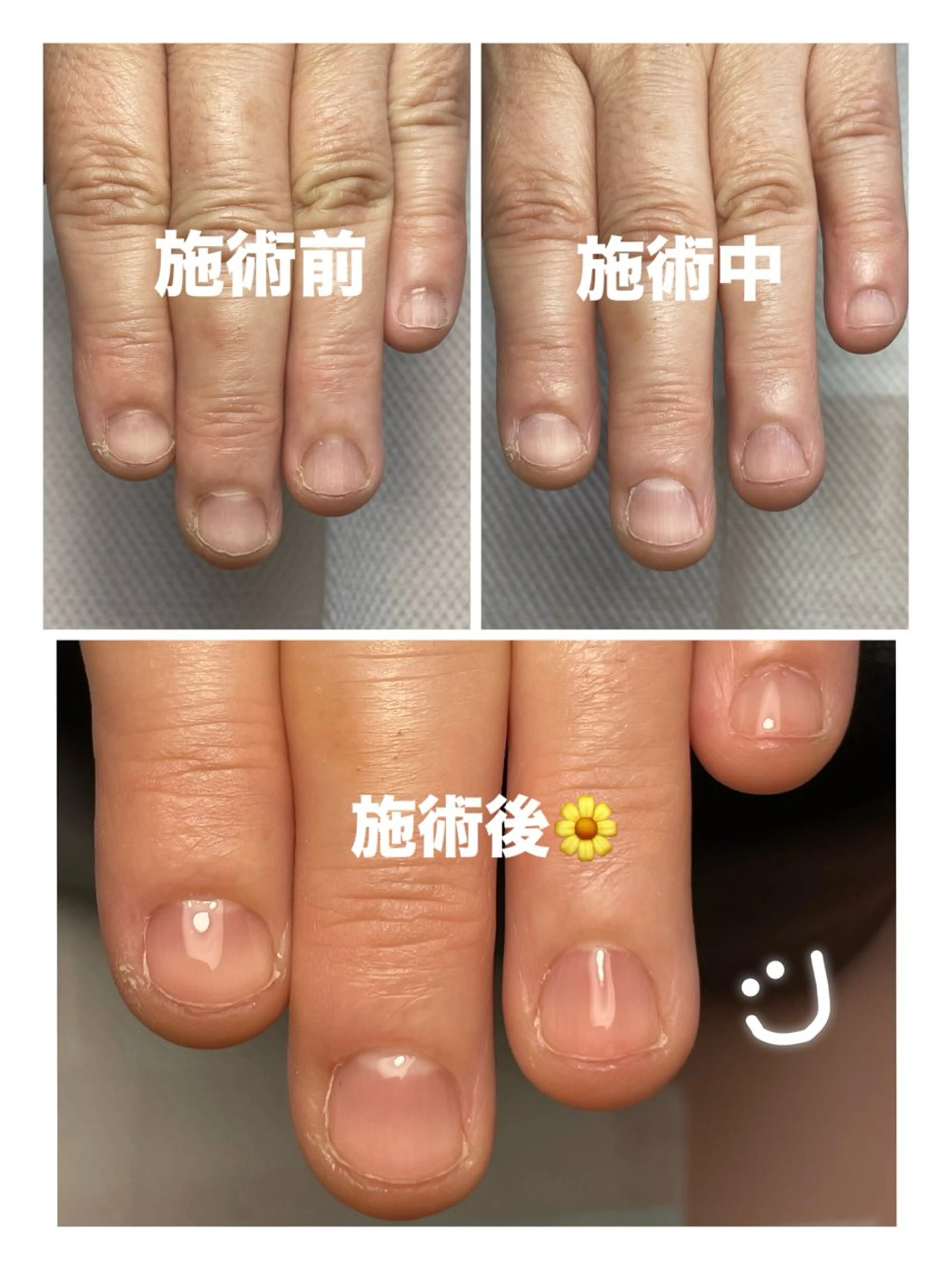 ネイル Chong Sarangのネイルデザイン