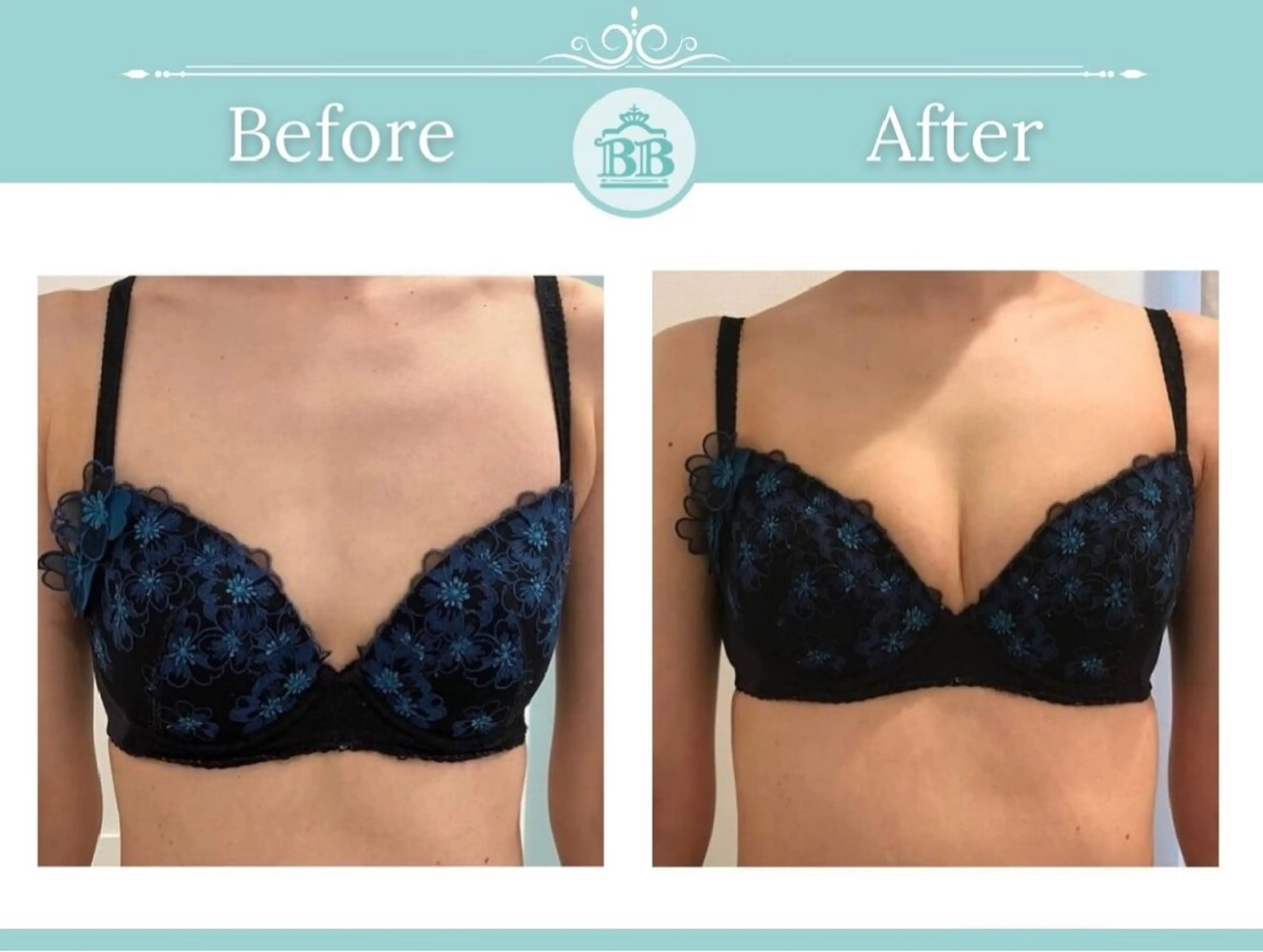 エステ 美人バスト 本厚木店のエステ・リラクイメージ