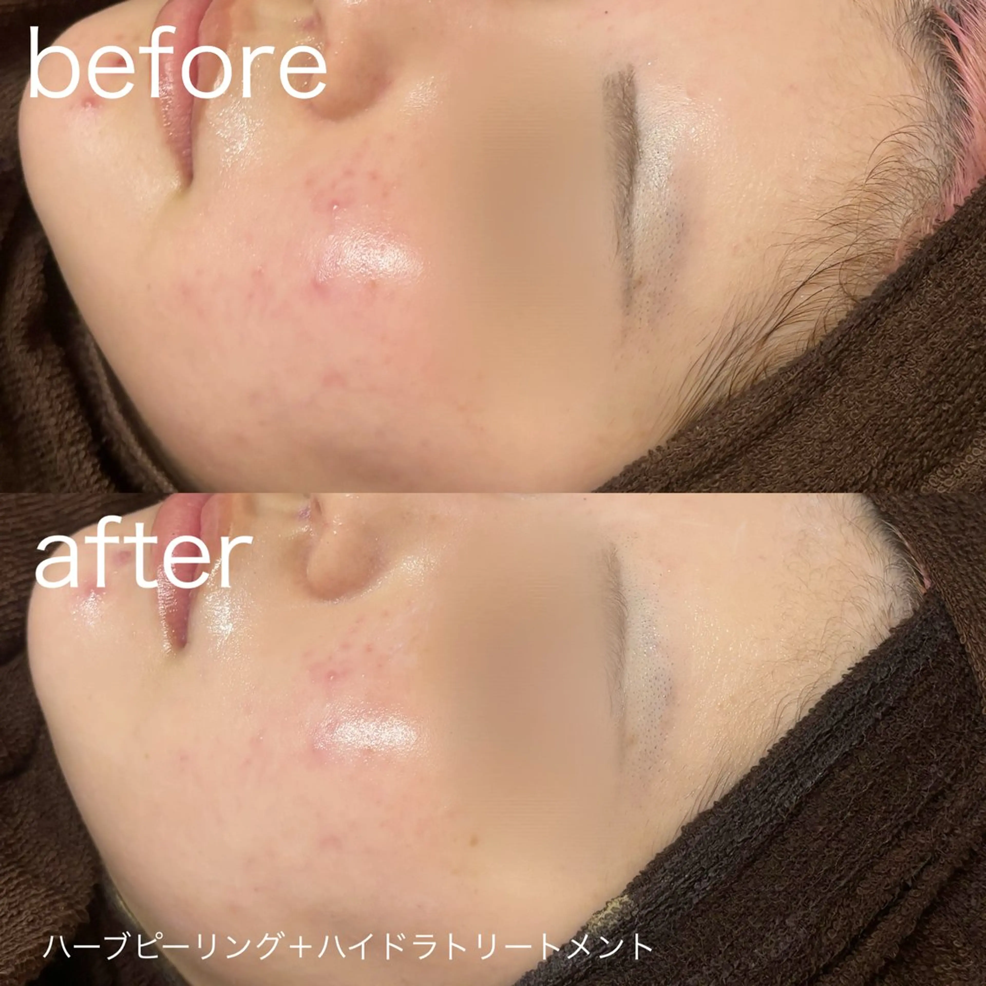 脱毛 lulularico Yuのエステ・リラクイメージ