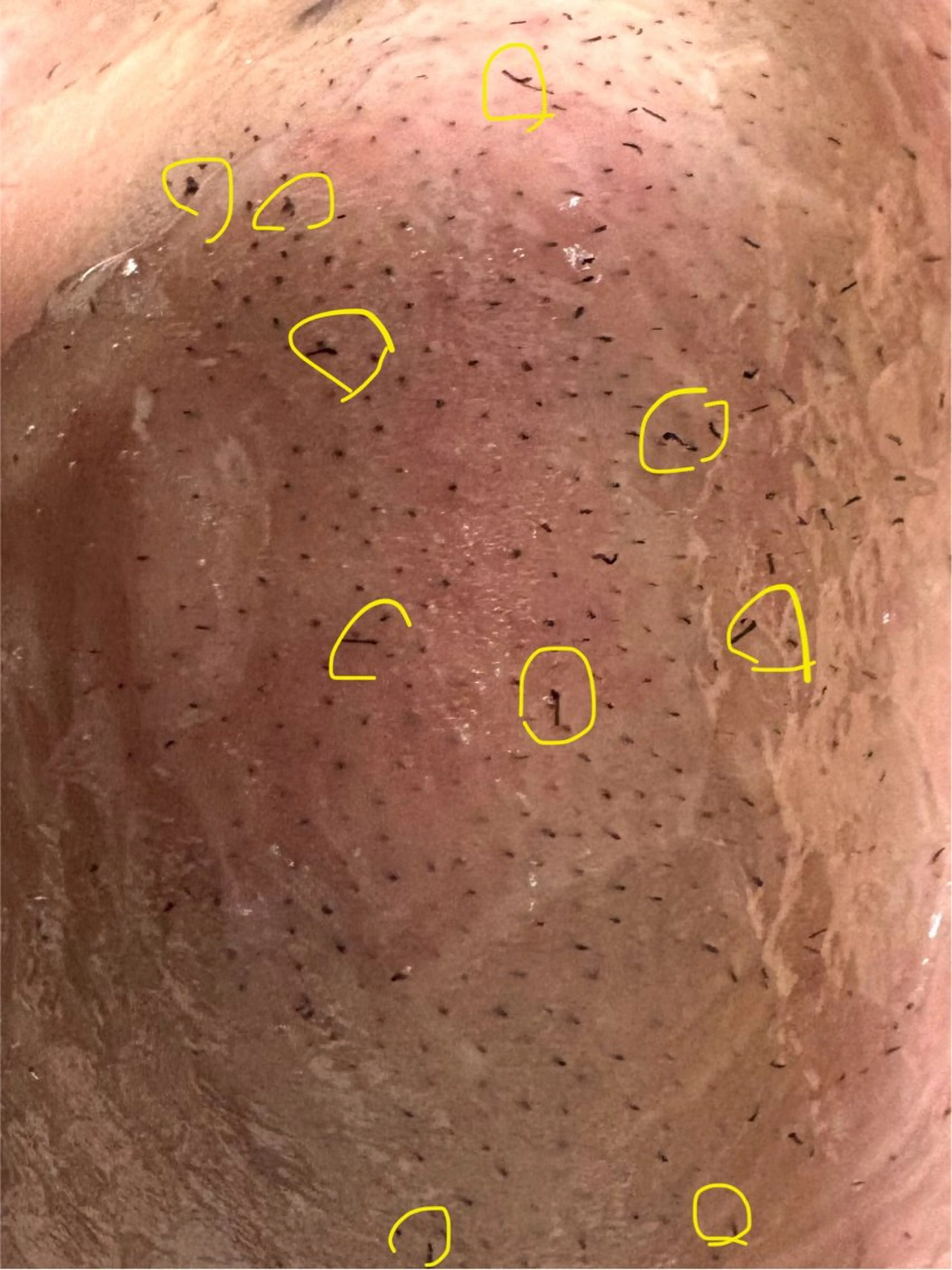 メンズ 高野 さおりのエステ・リラクイメージ