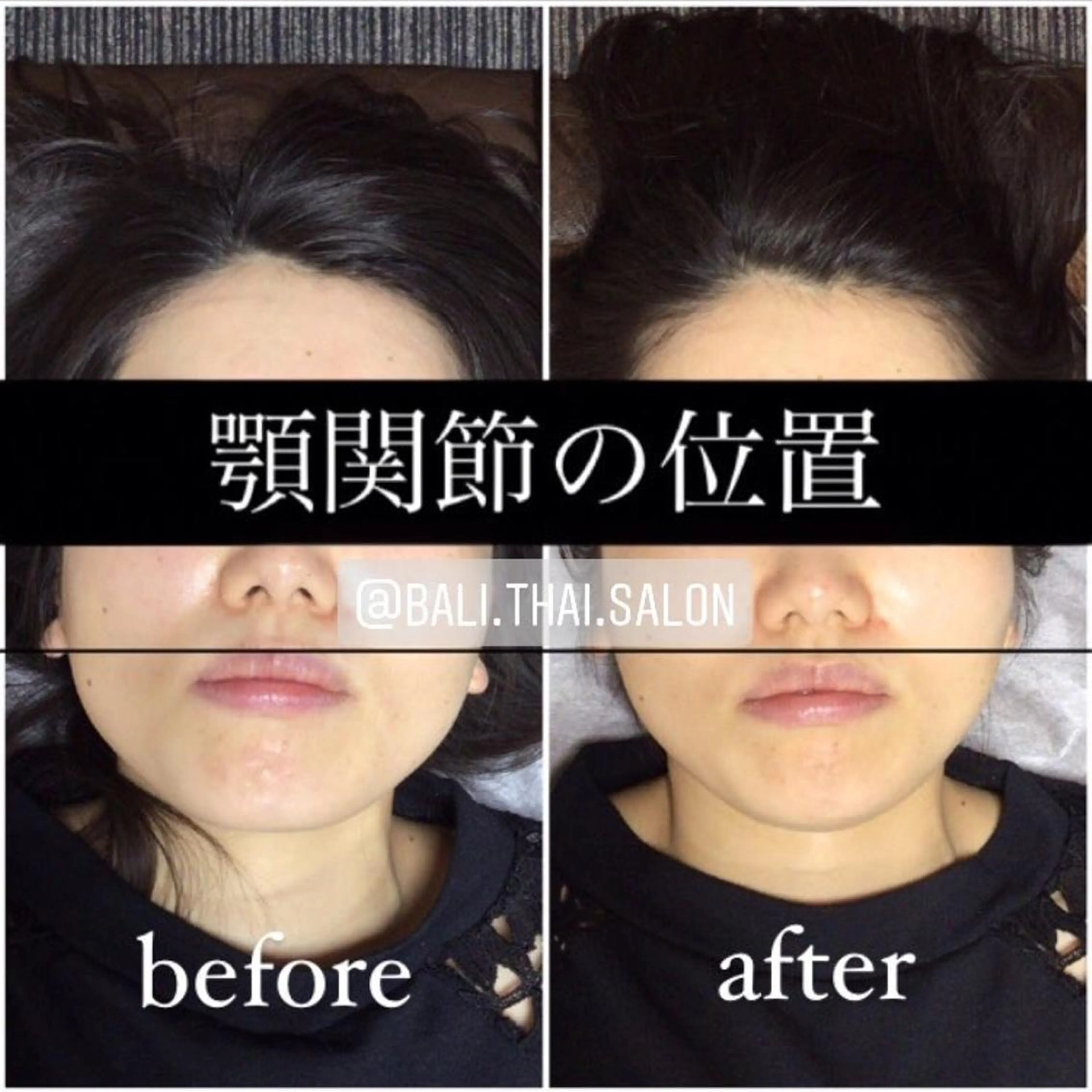 Z minimo限定❣️人気急上昇💕あご💆🏻‍♀️＋瞬間【首肩腰骨盤/全身矯正】顎と全身の歪みの写真